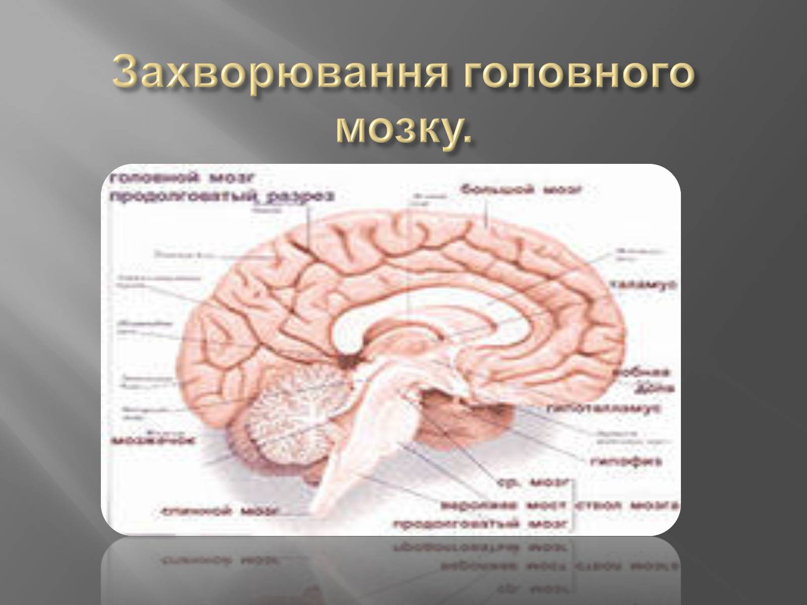 Презентація на тему «Захворювання головного мозку» - Слайд #1 Презентація на тему «Захворювання головного мозку» - Слайд #1