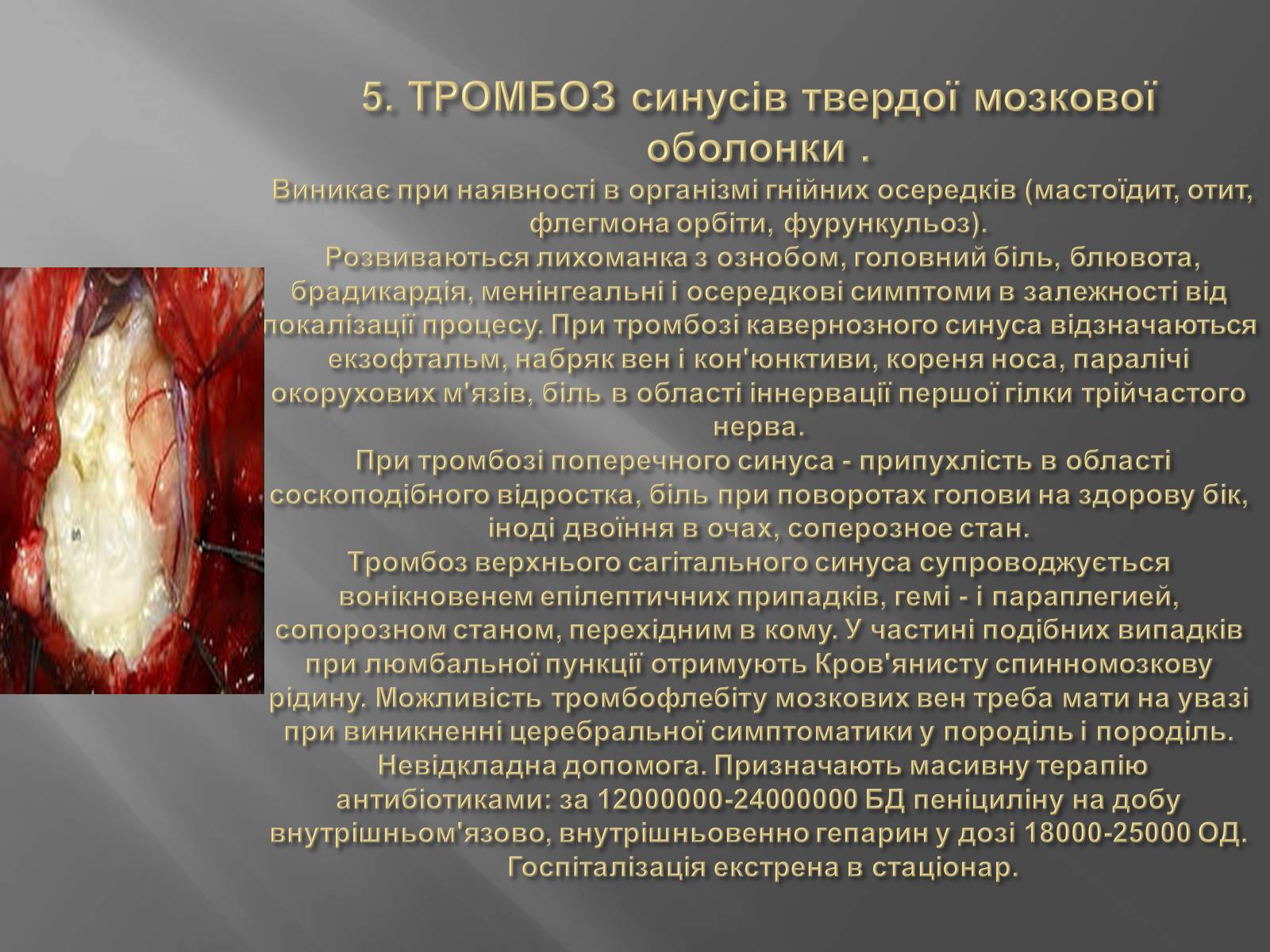 Презентація на тему «Захворювання головного мозку» - Слайд #7 Презентація на тему «Захворювання головного мозку» - Слайд #7