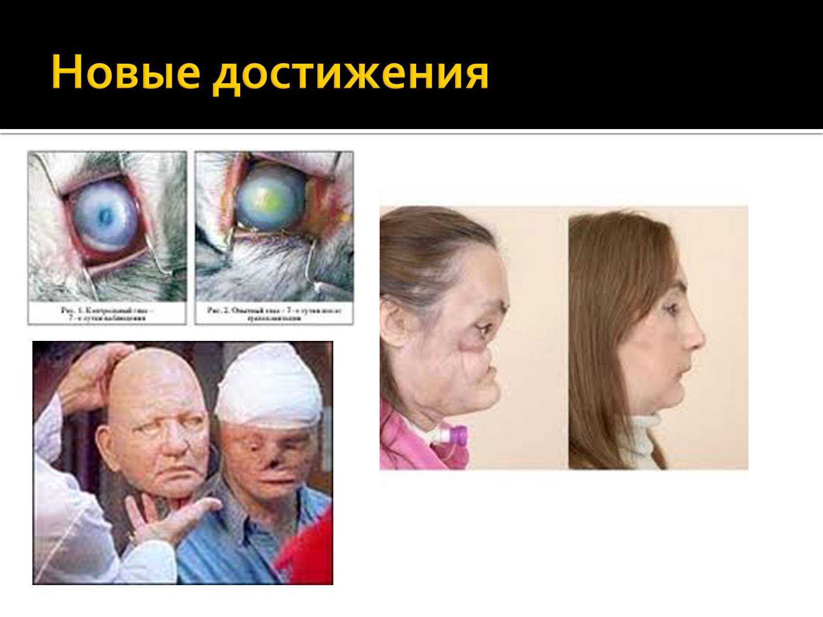 Презентація на тему «Трансплантація» - Слайд #17 Презентація на тему «Трансплантація» - Слайд #17