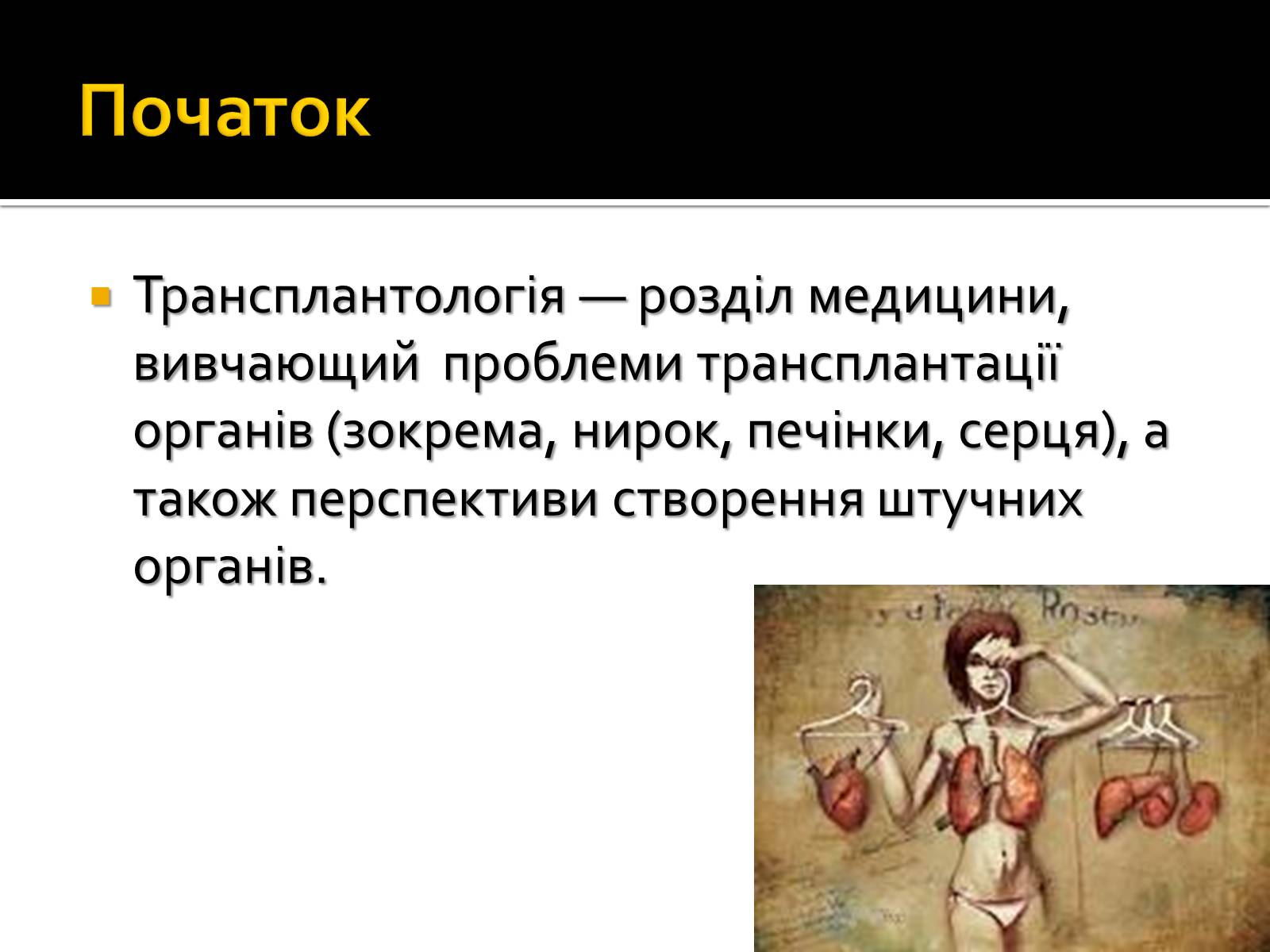 Презентація на тему «Трансплантація» - Слайд #3 Презентація на тему «Трансплантація» - Слайд #3