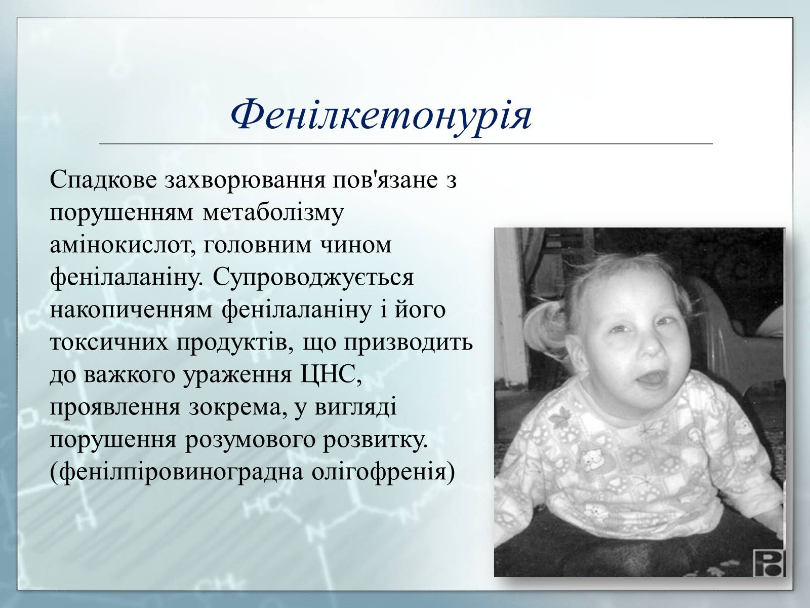 Презентація на тему «Генетика» (варіант 3) - Слайд #11 Презентація на тему «Генетика» (варіант 3) - Слайд #11