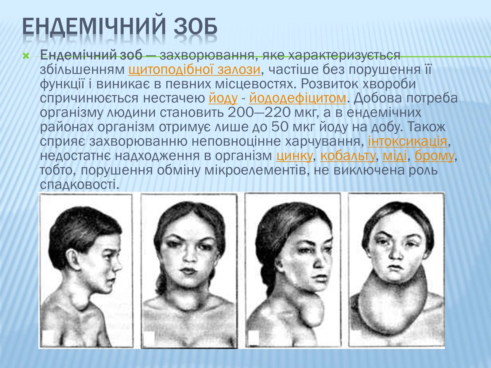 Презентація на тему «Ендемічні захворювання» (варіант 1) - Слайд #4 Презентація на тему «Ендемічні захворювання» (варіант 1) - Слайд #4