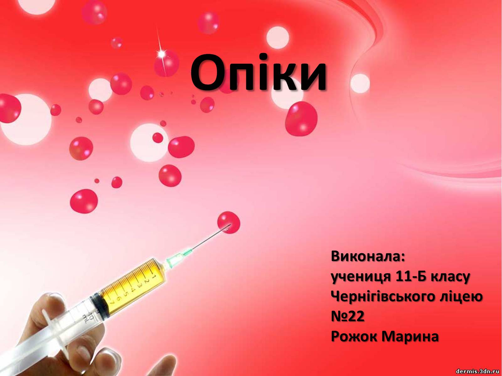 Презентація на тему «Опіки» (варіант 1) - Слайд #1 Презентація на тему «Опіки» (варіант 1) - Слайд #1