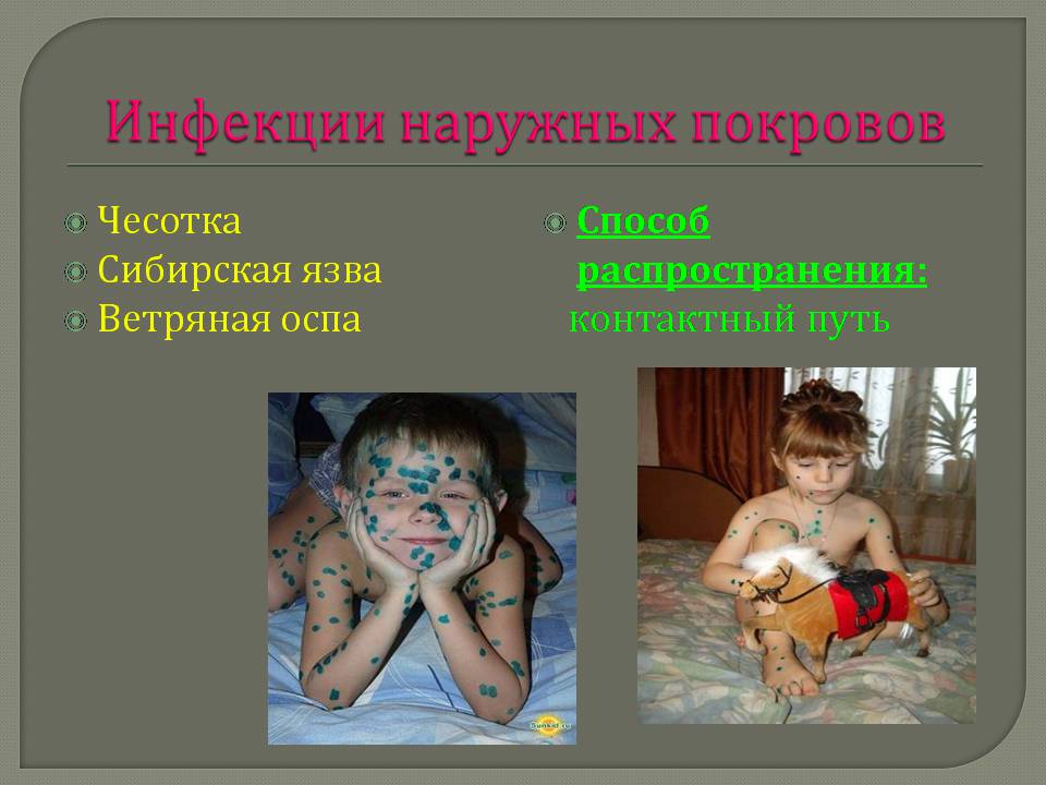 Презентація на тему «Инфекционные заболевания и их профилактика» - Слайд #12 Презентація на тему «Инфекционные заболевания и их профилактика» - Слайд #12