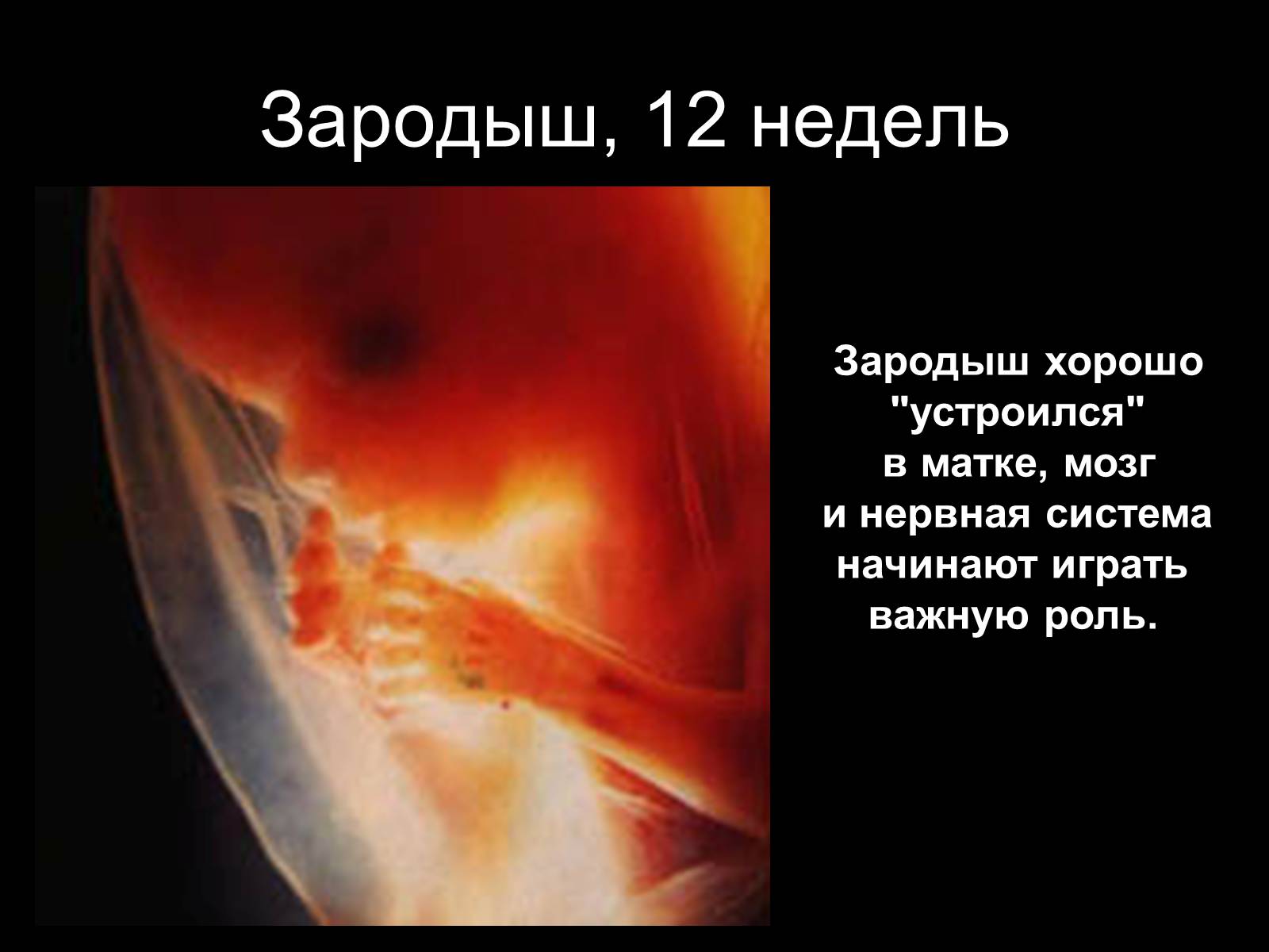 Презентація на тему «Половая система человека» (варіант 2) - Слайд #21 Презентація на тему «Половая система человека» (варіант 2) - Слайд #21