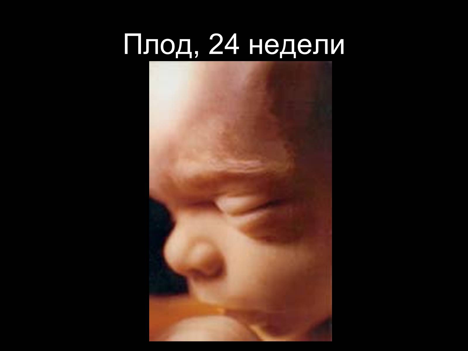 Презентація на тему «Половая система человека» (варіант 2) - Слайд #24 Презентація на тему «Половая система человека» (варіант 2) - Слайд #24