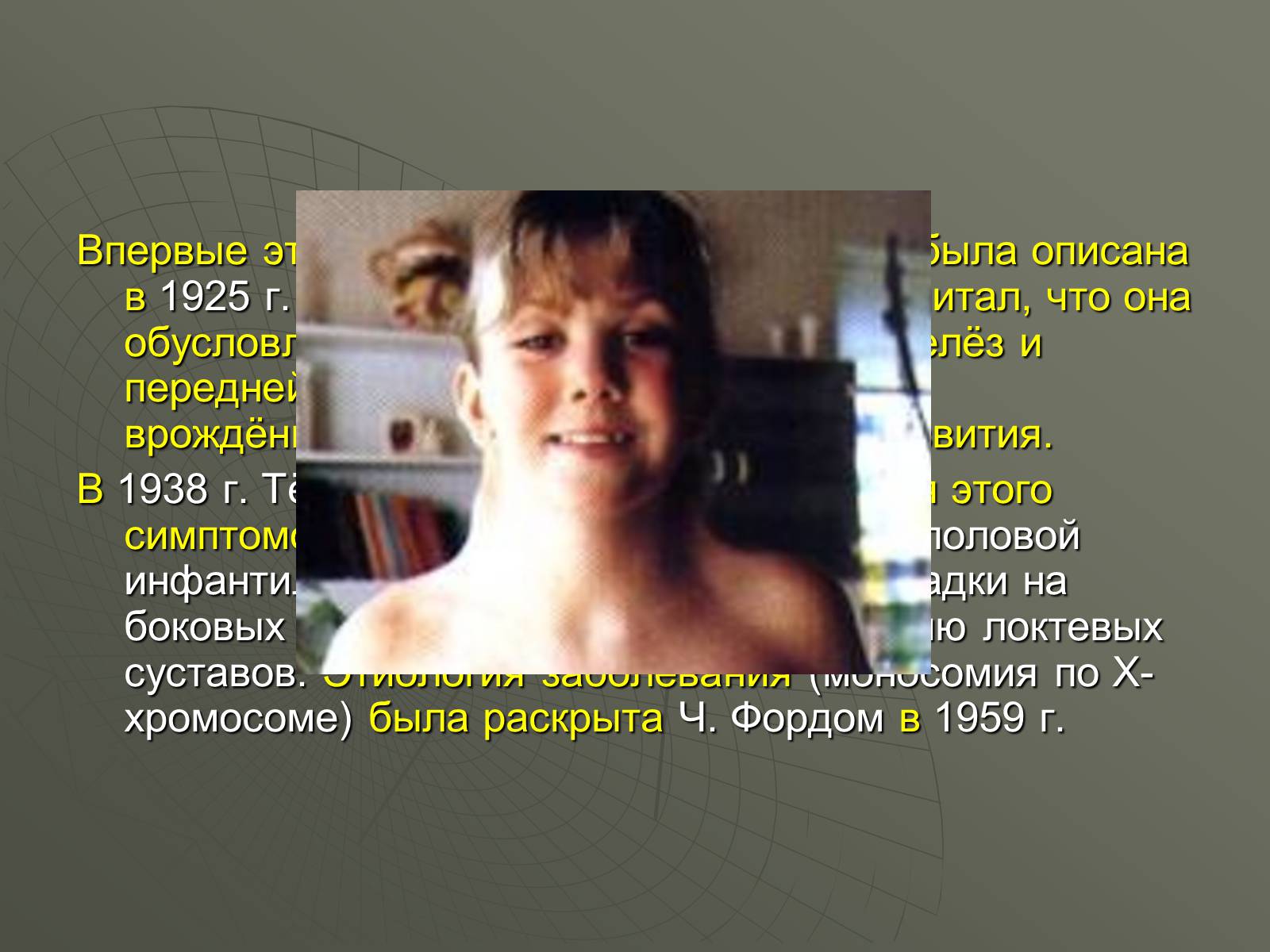 Презентація на тему «Генетические заболевания человека» - Слайд #7 Презентація на тему «Генетические заболевания человека» - Слайд #7