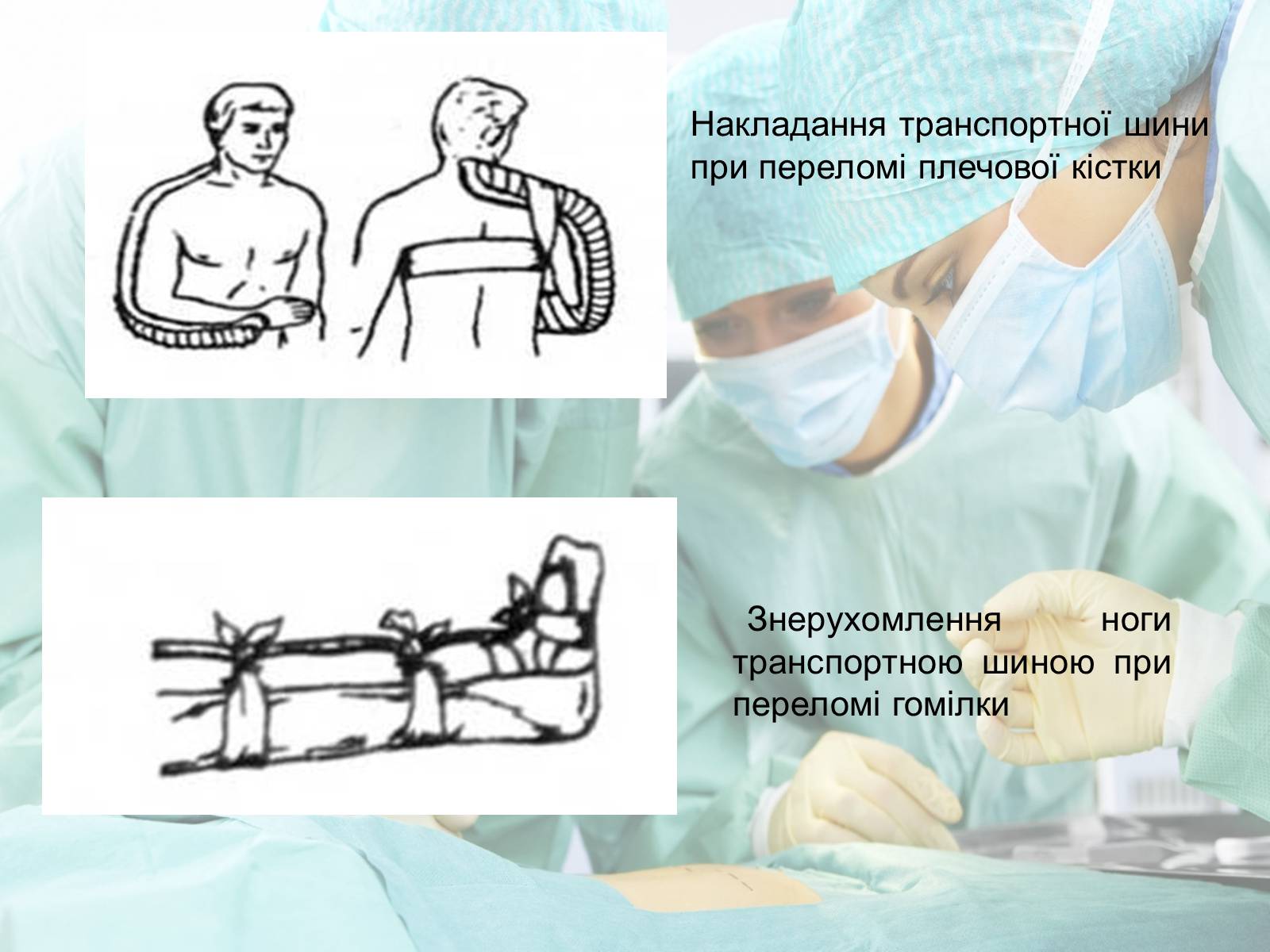 Презентація на тему «Переломи і вивихи» (варіант 2) - Слайд #17 Презентація на тему «Переломи і вивихи» (варіант 2) - Слайд #17