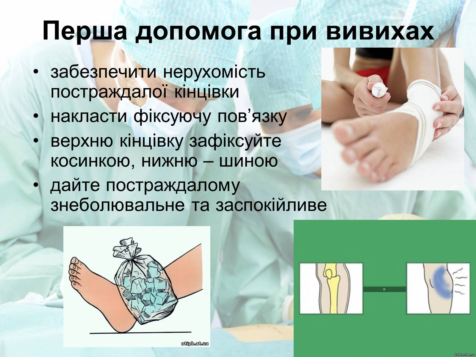 Презентація на тему «Переломи і вивихи» (варіант 2) - Слайд #6 Презентація на тему «Переломи і вивихи» (варіант 2) - Слайд #6