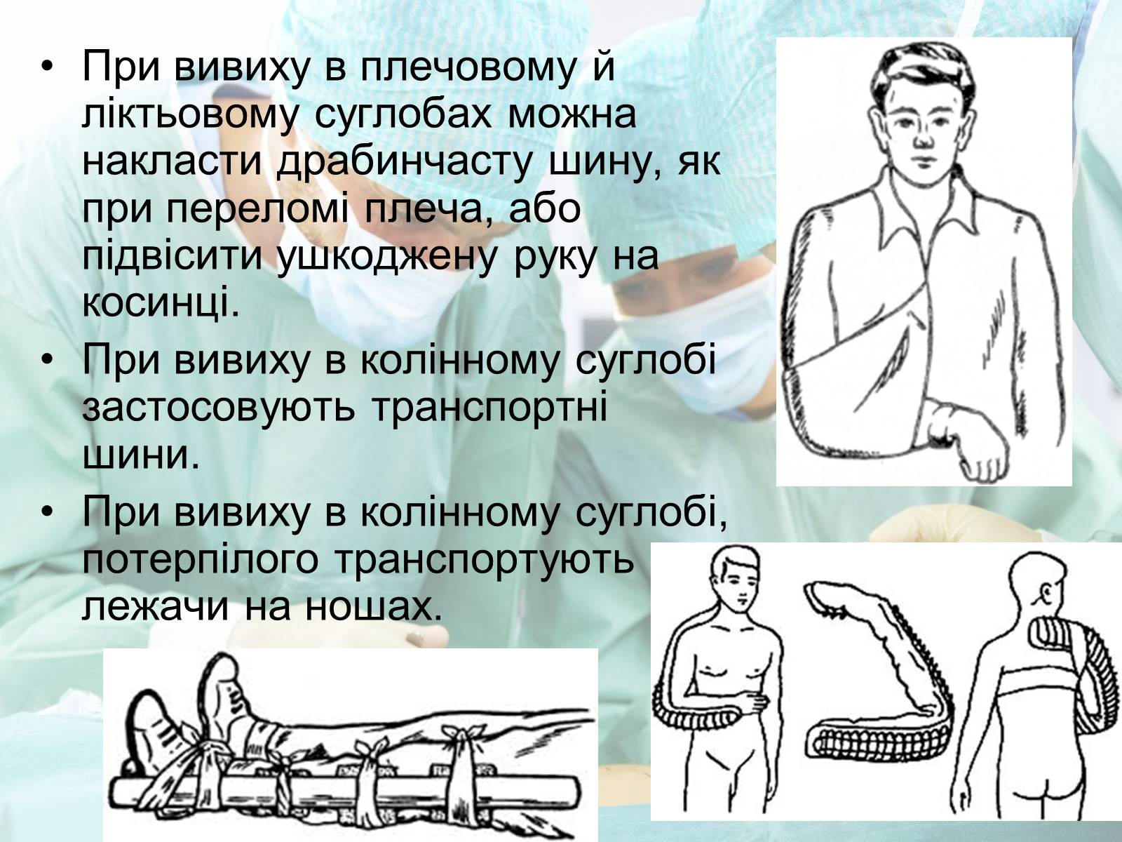 Презентація на тему «Переломи і вивихи» (варіант 2) - Слайд #7 Презентація на тему «Переломи і вивихи» (варіант 2) - Слайд #7