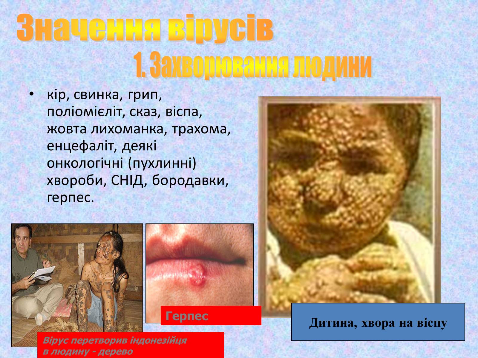 Презентація на тему «Віруси, їхня будова, життєвий цикл» (варіант 1) - Слайд #12 Презентація на тему «Віруси, їхня будова, життєвий цикл» (варіант 1) - Слайд #12