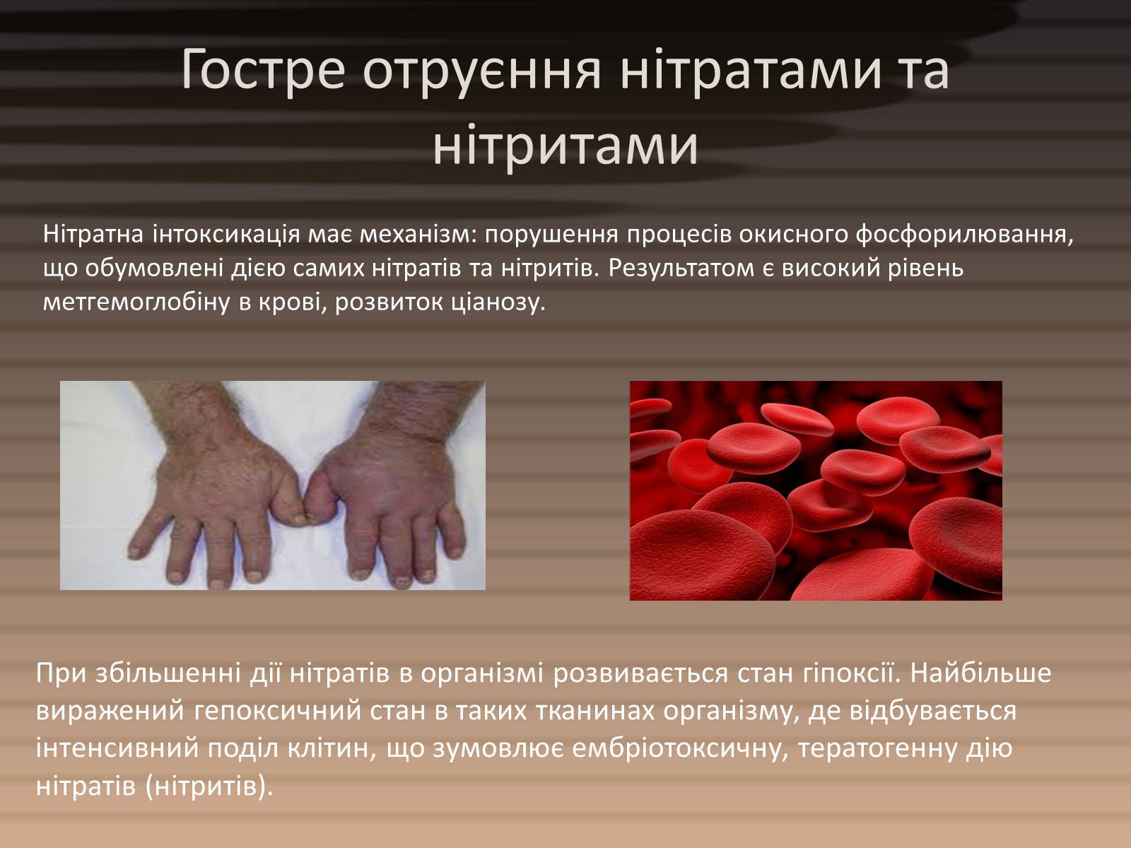 Презентація на тему «Вміст нітратів у харчових продуктах» - Слайд #7 Презентація на тему «Вміст нітратів у харчових продуктах» - Слайд #7