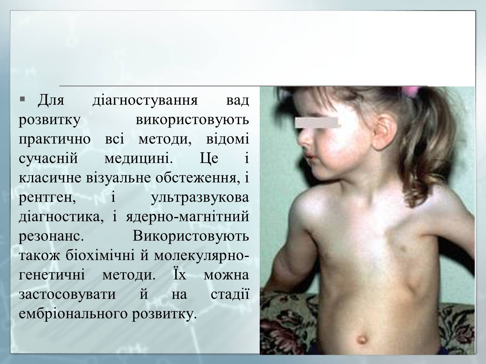 Презентація на тему «Діагностування вад розвитку людини та їх корегування» - Слайд #11 Презентація на тему «Діагностування вад розвитку людини та їх корегування» - Слайд #11