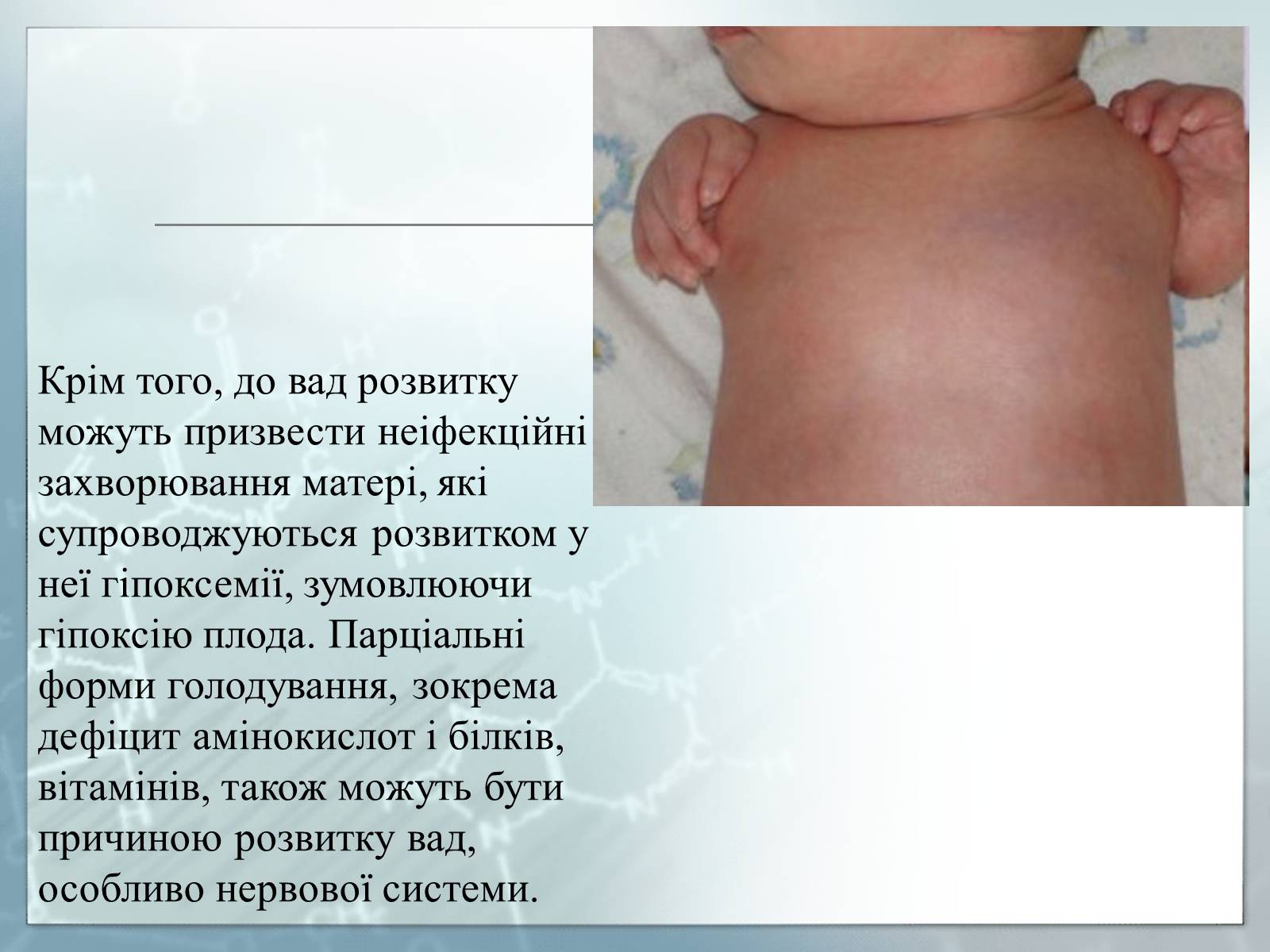 Презентація на тему «Діагностування вад розвитку людини та їх корегування» - Слайд #15 Презентація на тему «Діагностування вад розвитку людини та їх корегування» - Слайд #15