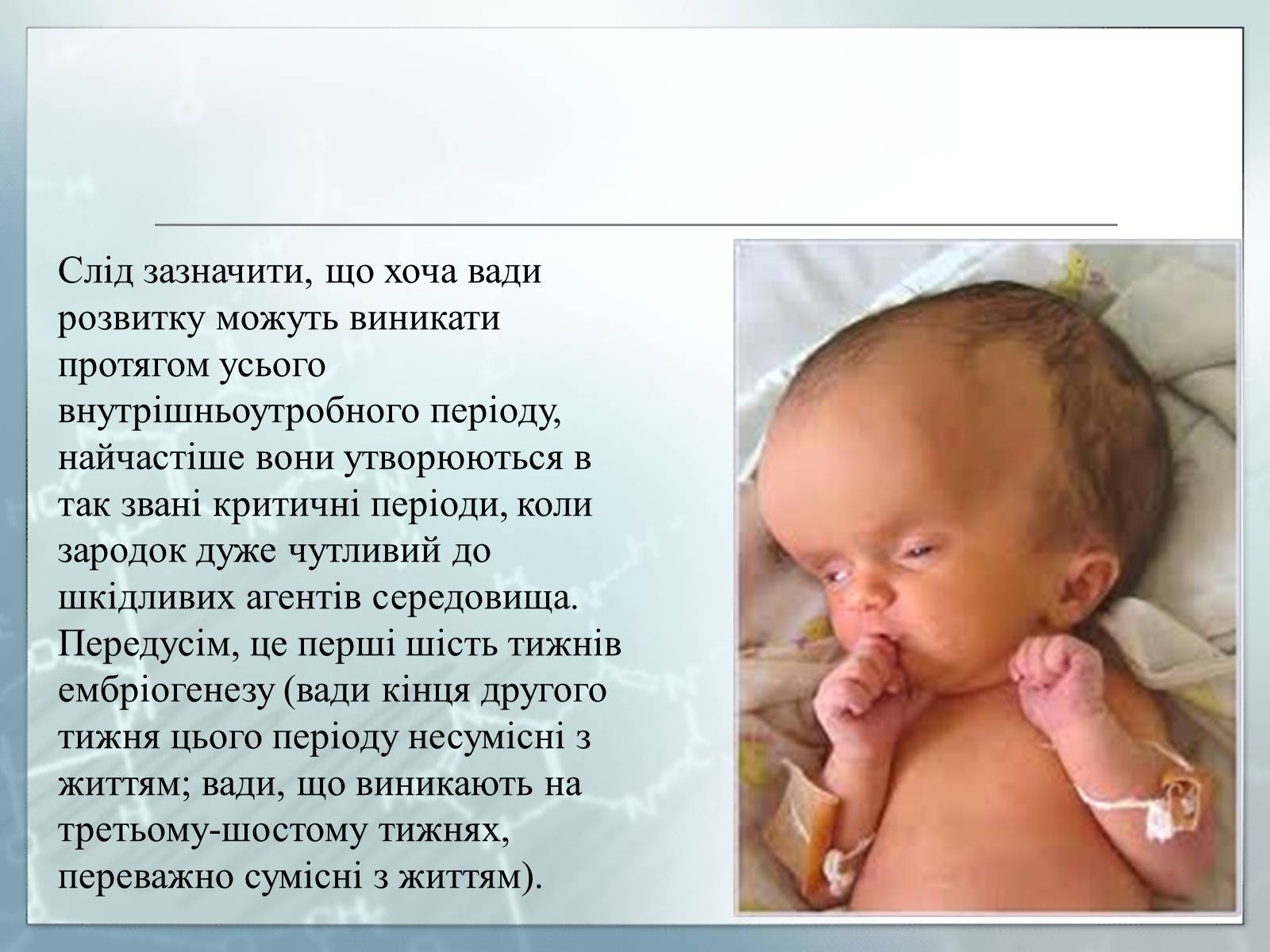 Презентація на тему «Діагностування вад розвитку людини та їх корегування» - Слайд #16 Презентація на тему «Діагностування вад розвитку людини та їх корегування» - Слайд #16