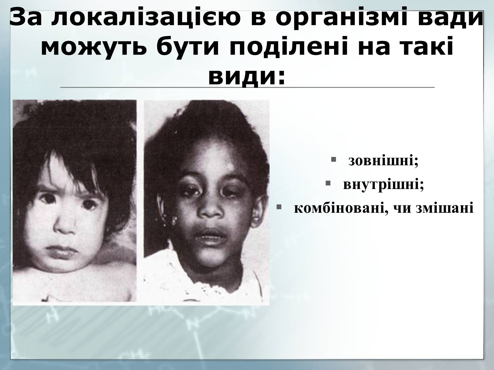 Презентація на тему «Діагностування вад розвитку людини та їх корегування» - Слайд #5 Презентація на тему «Діагностування вад розвитку людини та їх корегування» - Слайд #5
