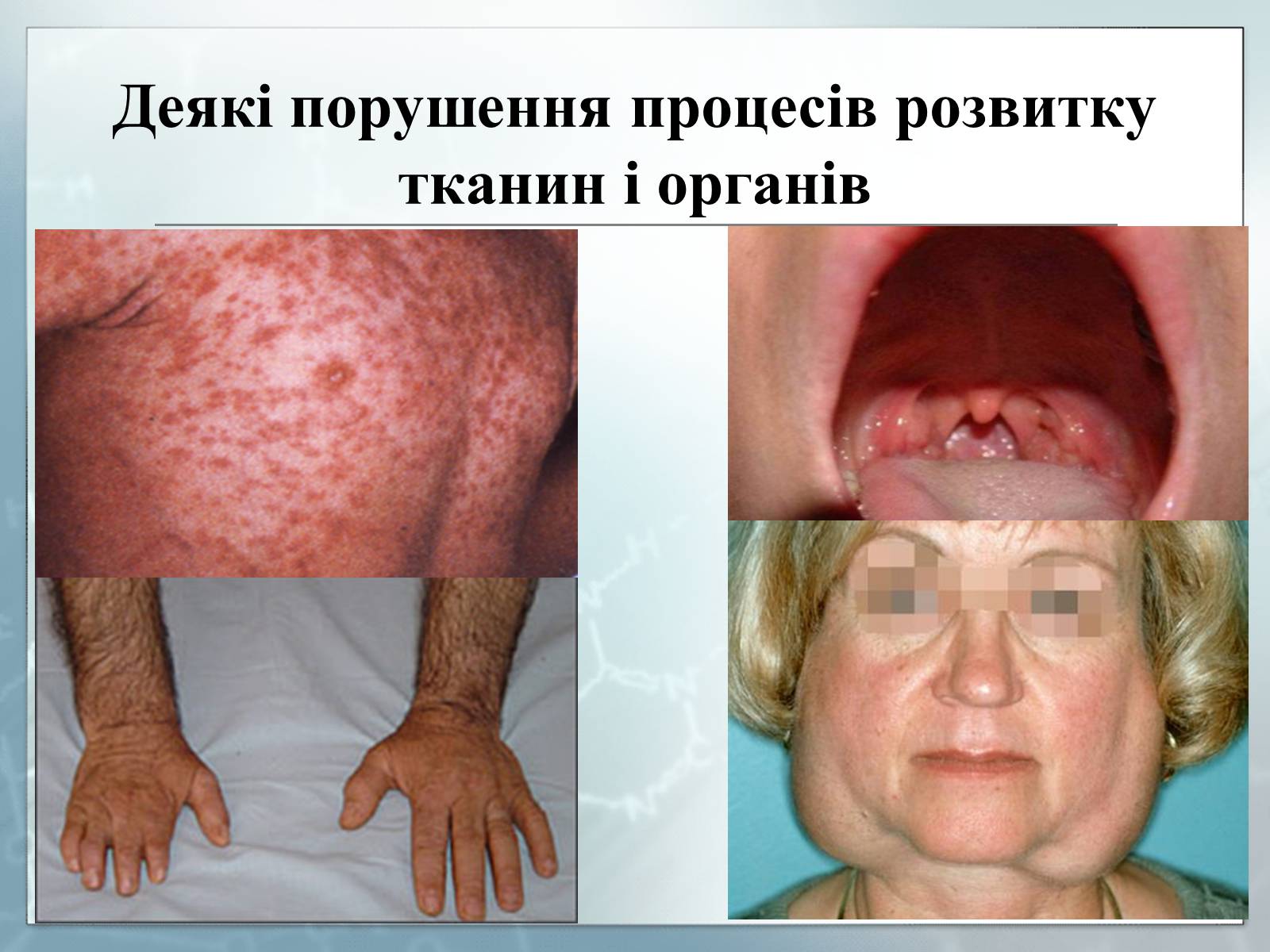 Презентація на тему «Діагностування вад розвитку людини та їх корегування» - Слайд #9 Презентація на тему «Діагностування вад розвитку людини та їх корегування» - Слайд #9