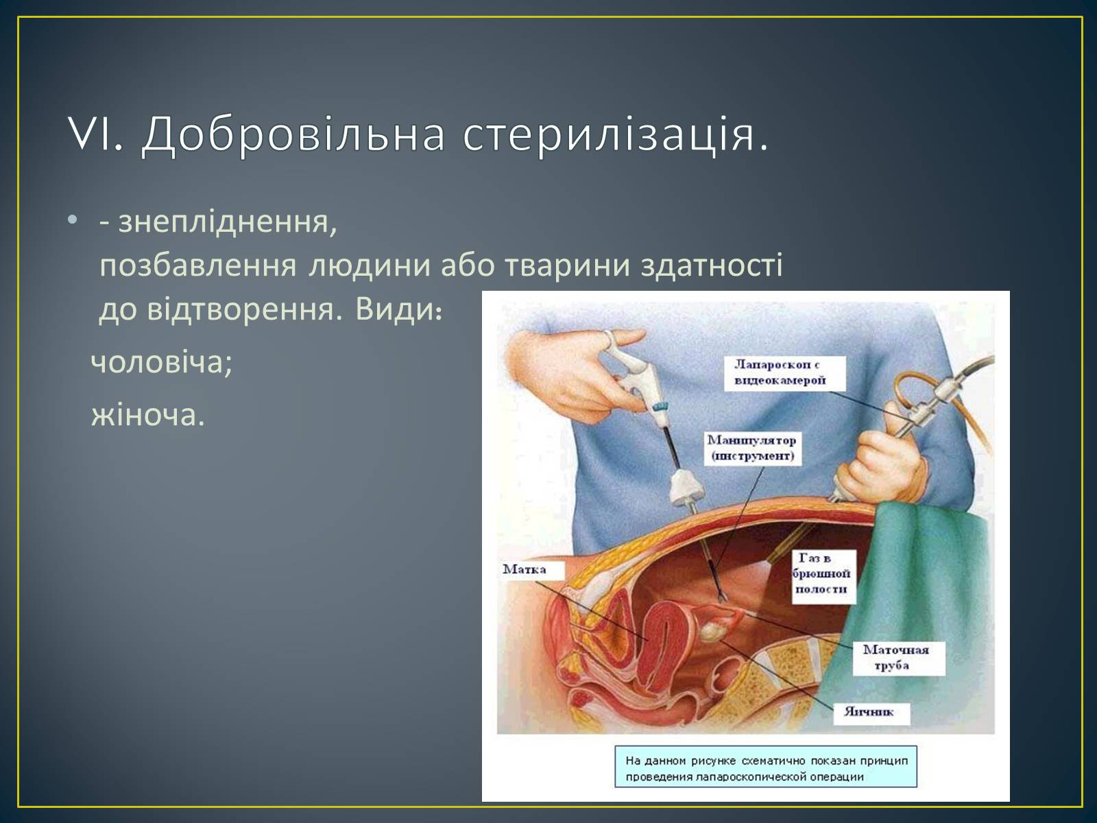 Презентація на тему «Контрацепція» (варіант 1) - Слайд #14 Презентація на тему «Контрацепція» (варіант 1) - Слайд #14
