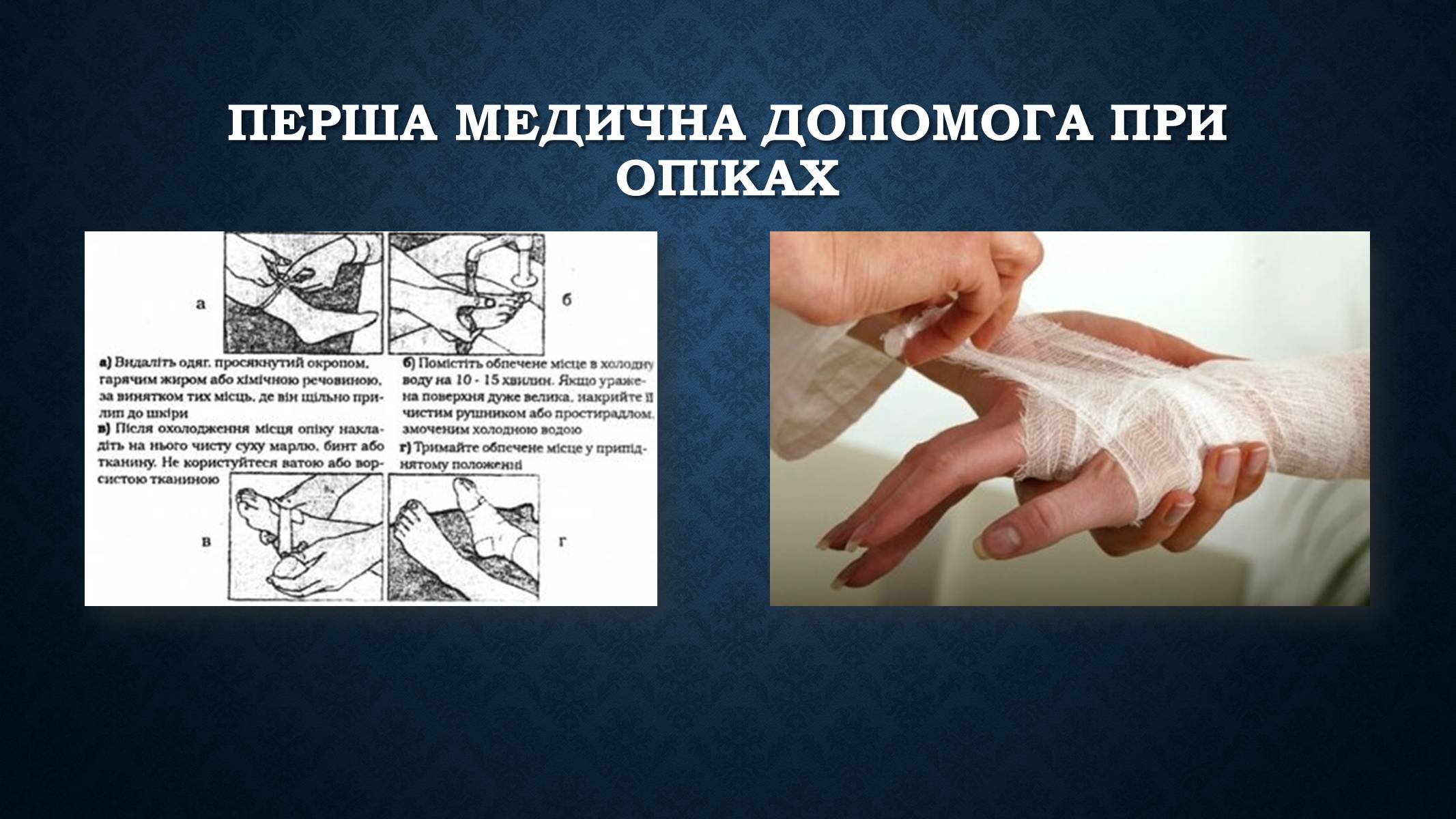 Презентація на тему «Опіки та отруєння організму людини» - Слайд #10 Презентація на тему «Опіки та отруєння організму людини» - Слайд #10