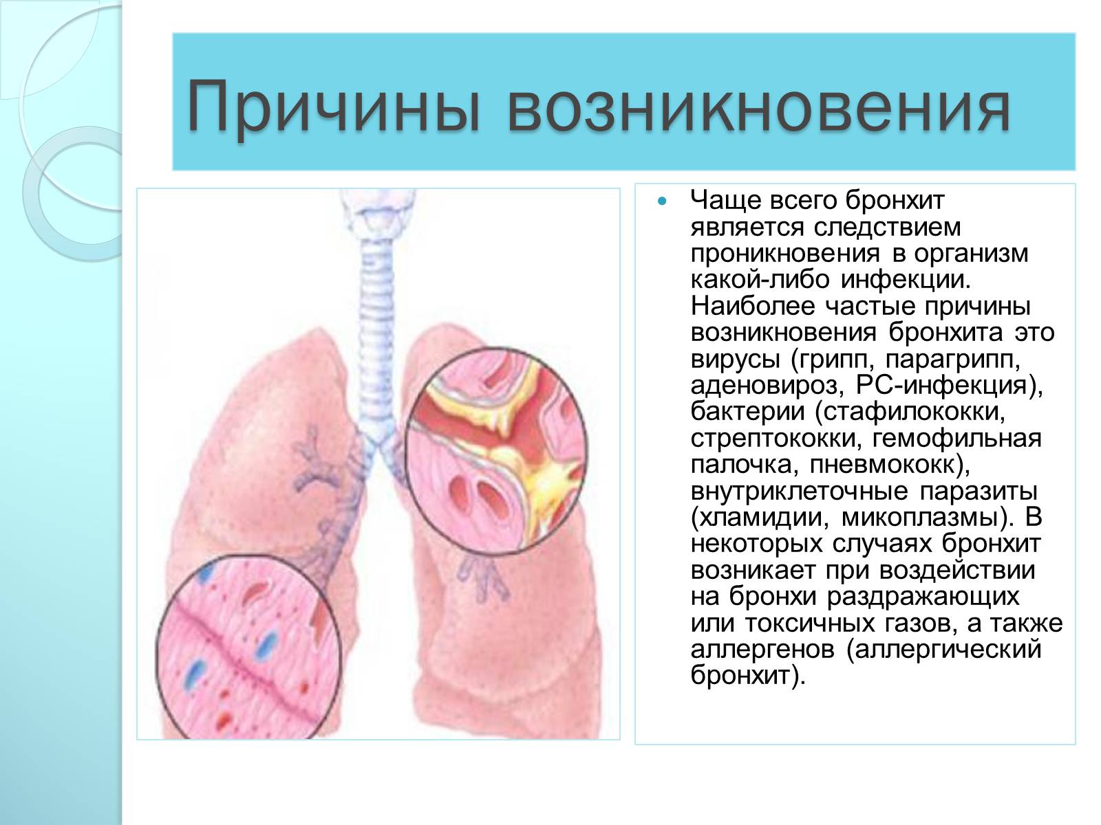 Презентація на тему «Инфекционные болезни дыхательной системы» - Слайд #9 Презентація на тему «Инфекционные болезни дыхательной системы» - Слайд #9
