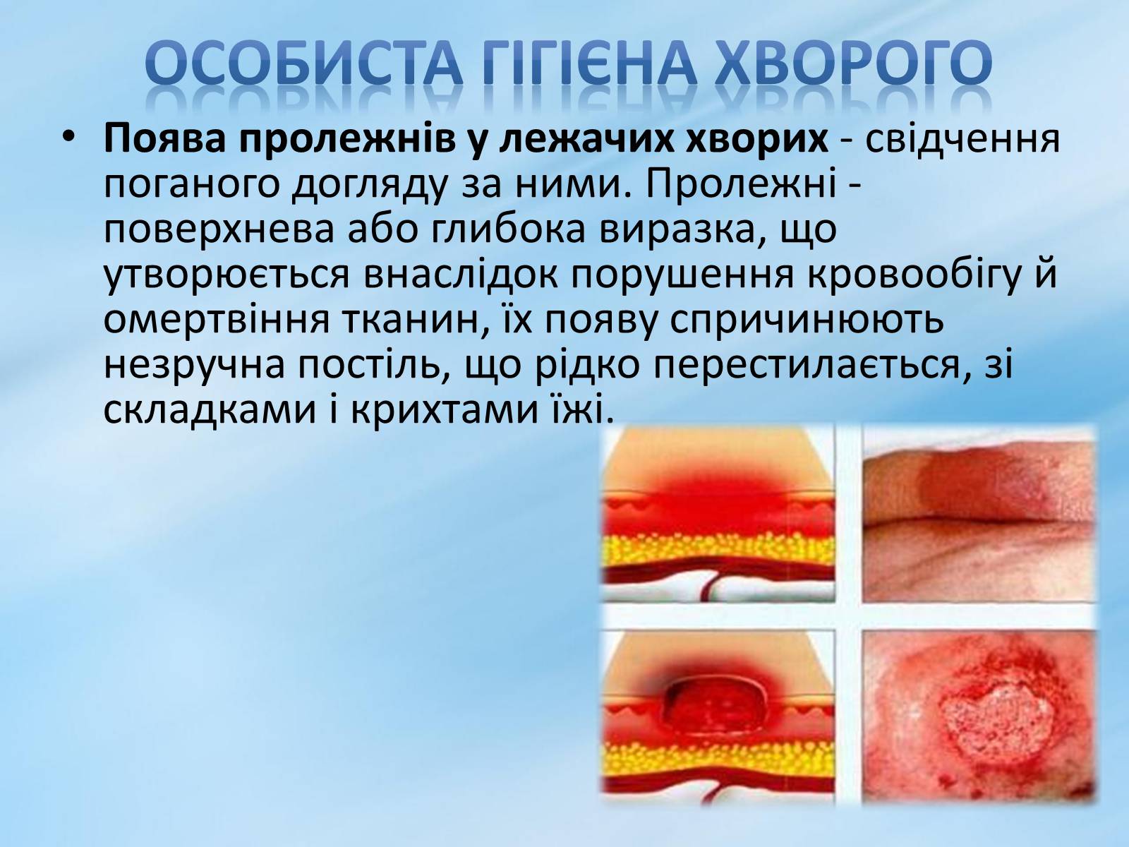 Презентація на тему «Перша допомога та догляд за хворими» - Слайд #21 Презентація на тему «Перша допомога та догляд за хворими» - Слайд #21