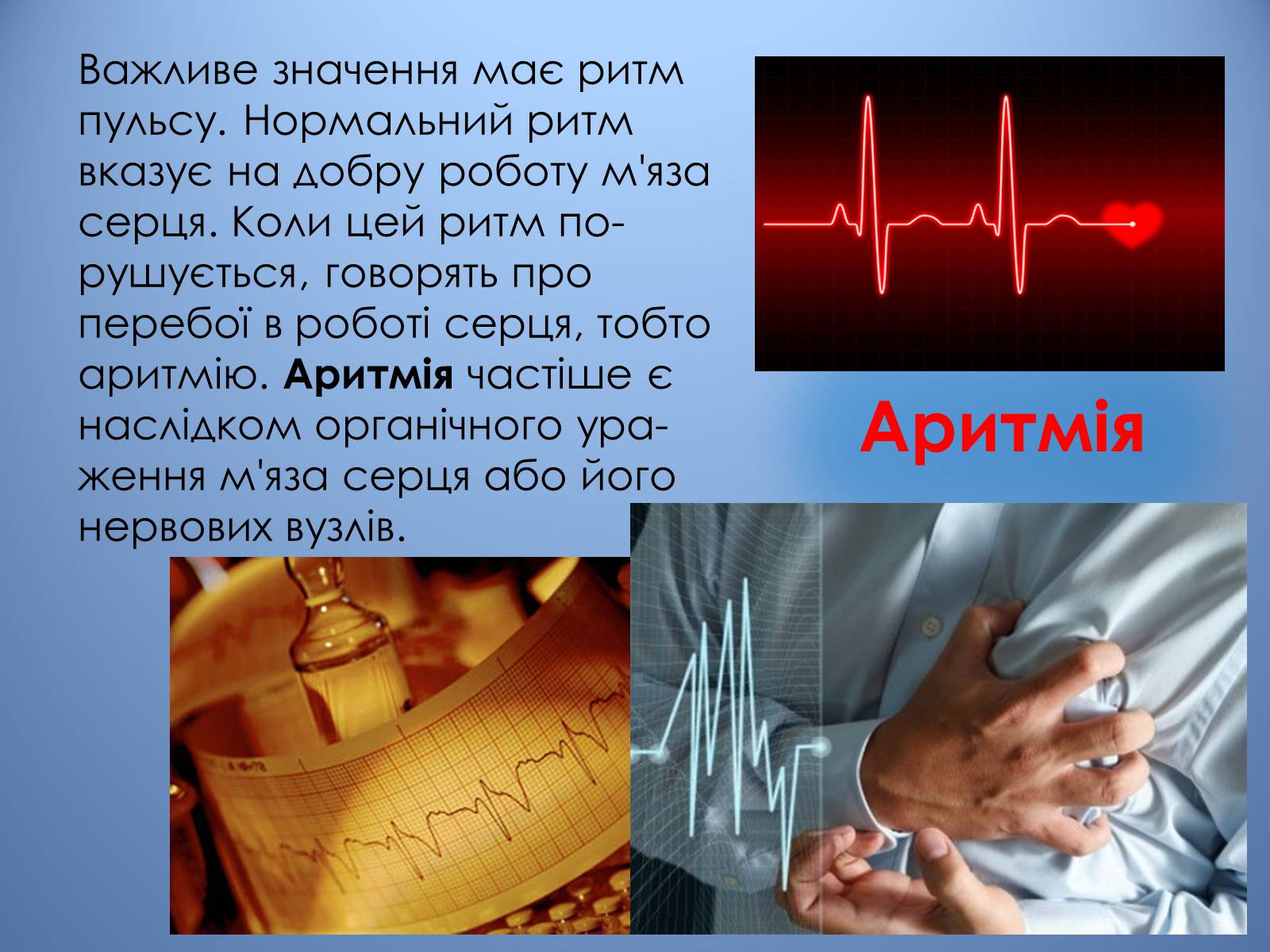 Презентація на тему «Порушення діяльності серцево-судинної системи» - Слайд #10 Презентація на тему «Порушення діяльності серцево-судинної системи» - Слайд #10