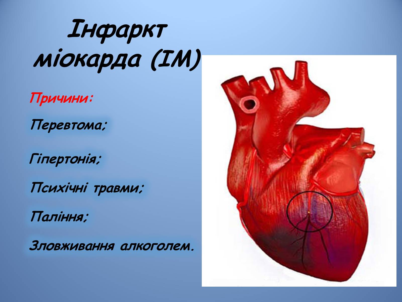 Презентація на тему «Порушення діяльності серцево-судинної системи» - Слайд #4 Презентація на тему «Порушення діяльності серцево-судинної системи» - Слайд #4