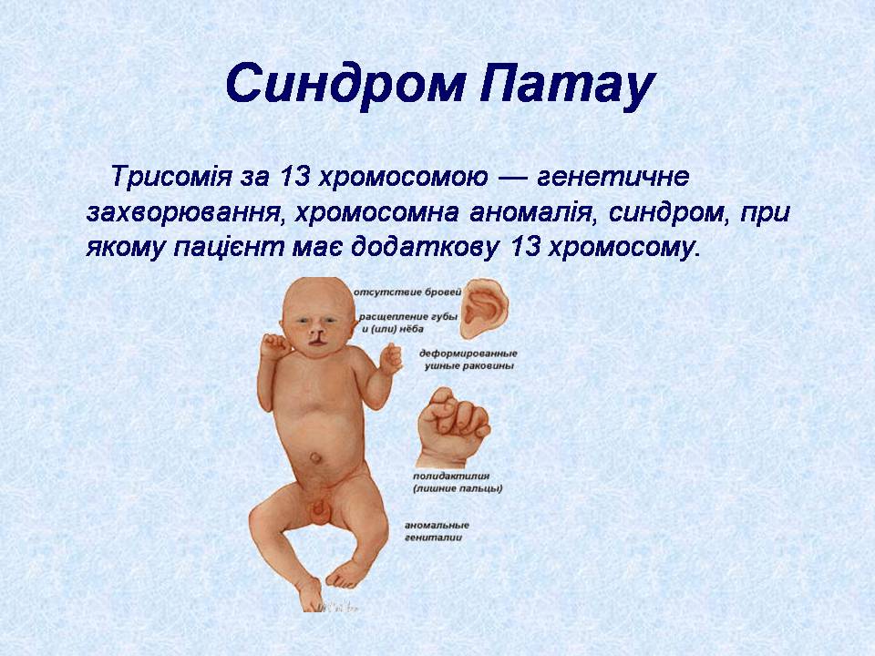 Презентація на тему «Геномні порушення» - Слайд #14 Презентація на тему «Геномні порушення» - Слайд #14