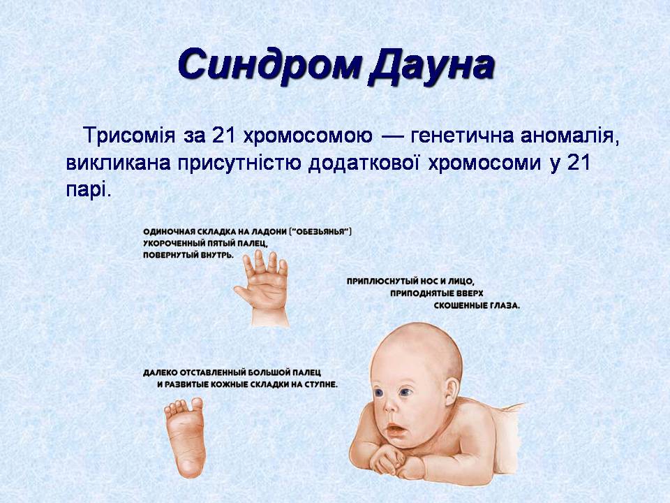 Презентація на тему «Геномні порушення» - Слайд #4 Презентація на тему «Геномні порушення» - Слайд #4