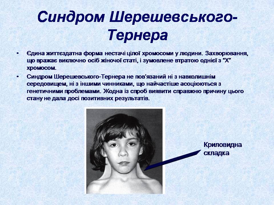 Презентація на тему «Геномні порушення» - Слайд #8 Презентація на тему «Геномні порушення» - Слайд #8