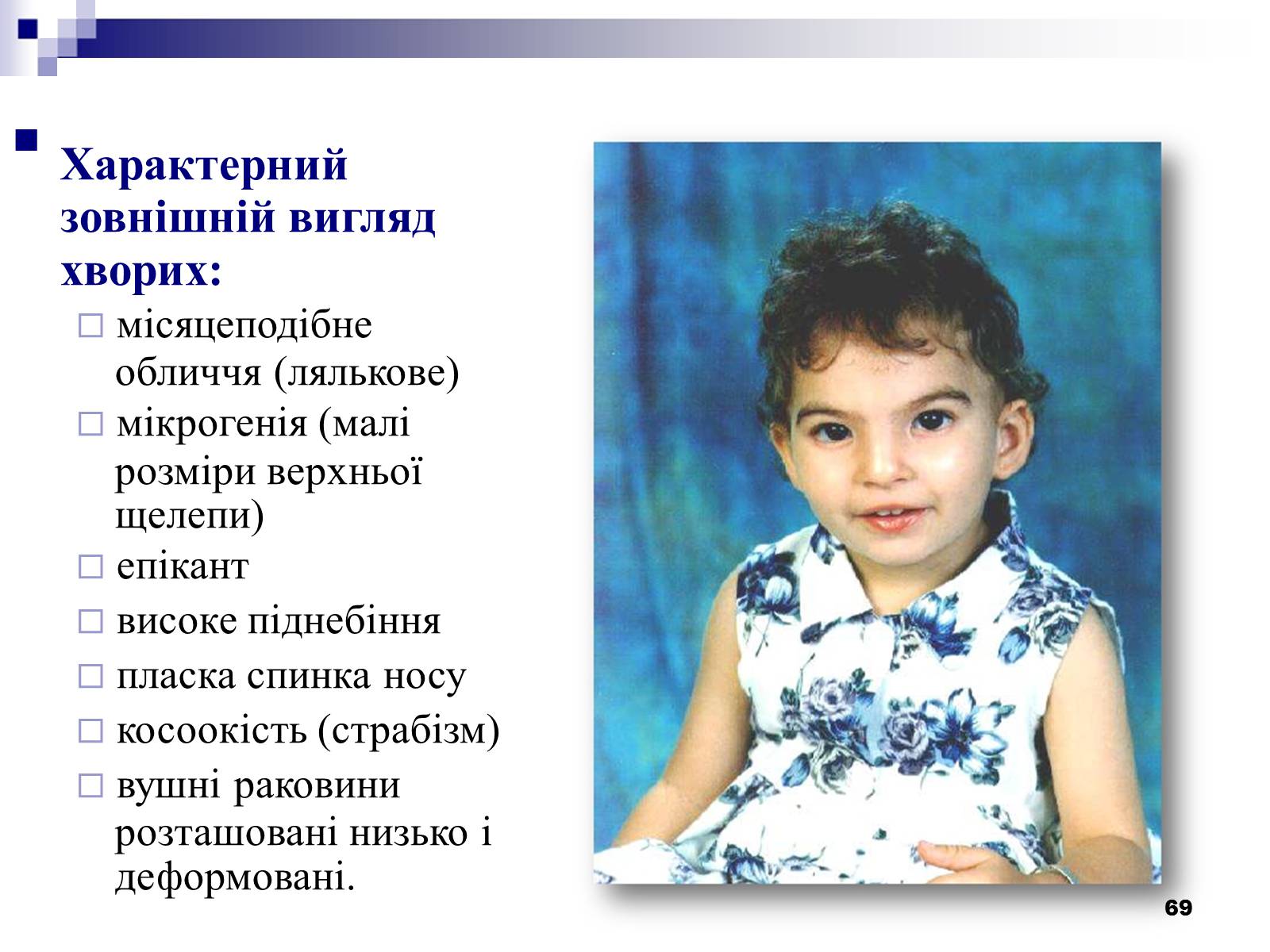 Презентація на тему «Хромосомні хвороби» (варіант 2) - Слайд #38 Презентація на тему «Хромосомні хвороби» (варіант 2) - Слайд #38
