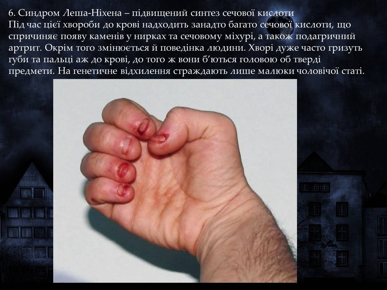 Презентація на тему «Мутації» (варіант 1) - Слайд #14 Презентація на тему «Мутації» (варіант 1) - Слайд #14