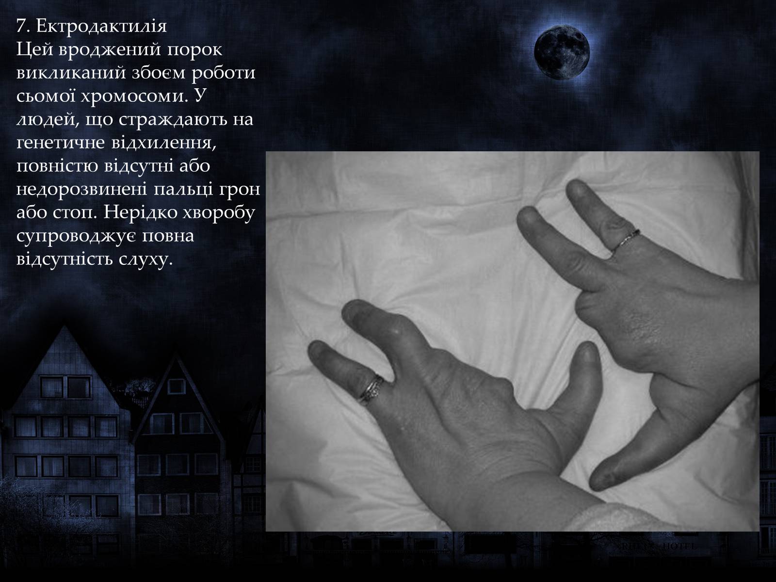 Презентація на тему «Мутації» (варіант 1) - Слайд #15 Презентація на тему «Мутації» (варіант 1) - Слайд #15