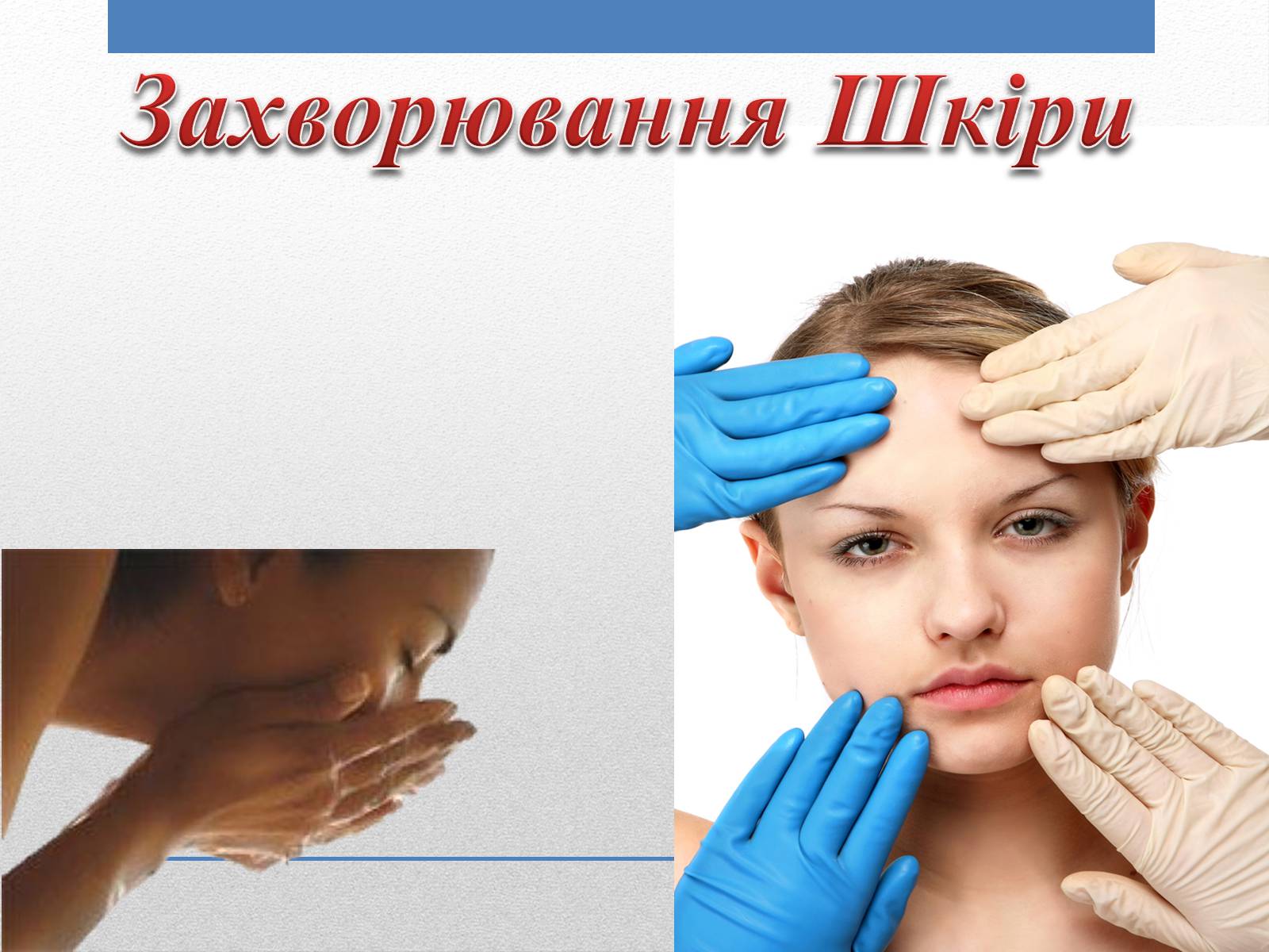 Презентація на тему «Захворювання Шкіри» (варіант 1) - Слайд #1 Презентація на тему «Захворювання Шкіри» (варіант 1) - Слайд #1