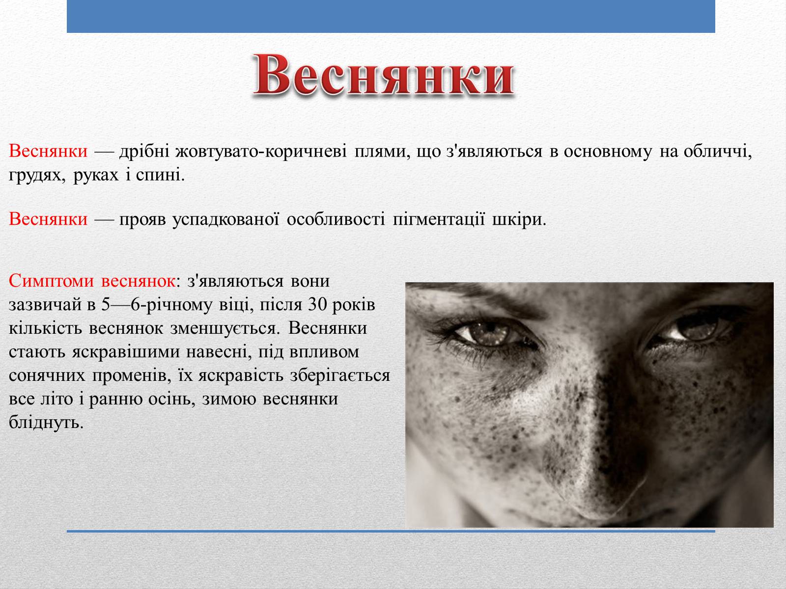 Презентація на тему «Захворювання Шкіри» (варіант 1) - Слайд #5 Презентація на тему «Захворювання Шкіри» (варіант 1) - Слайд #5
