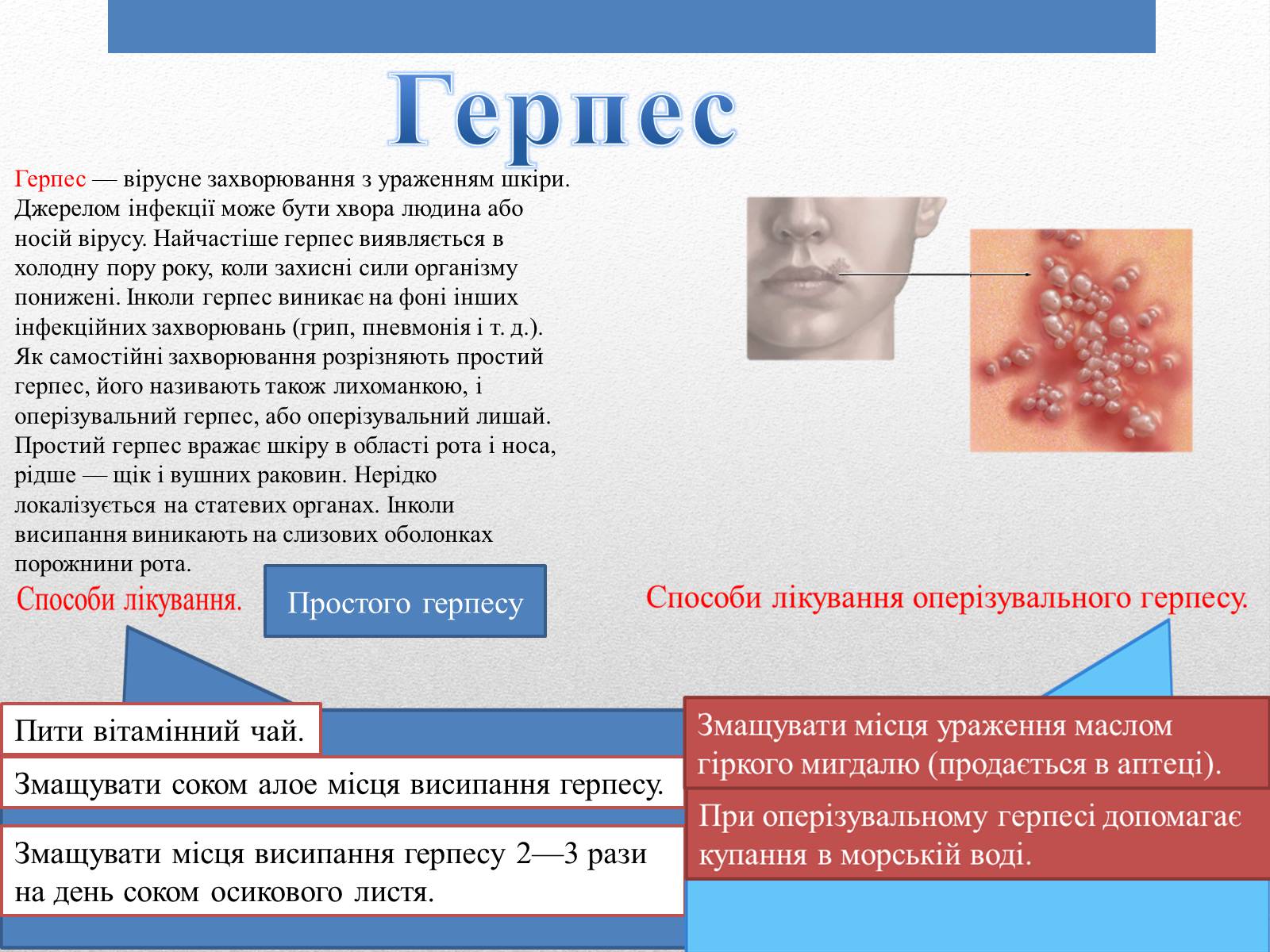 Презентація на тему «Захворювання Шкіри» (варіант 1) - Слайд #8 Презентація на тему «Захворювання Шкіри» (варіант 1) - Слайд #8