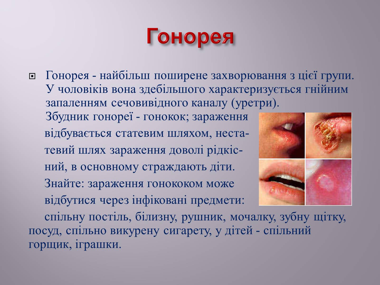 Презентація на тему «Венеричні хвороби» - Слайд #3 Презентація на тему «Венеричні хвороби» - Слайд #3