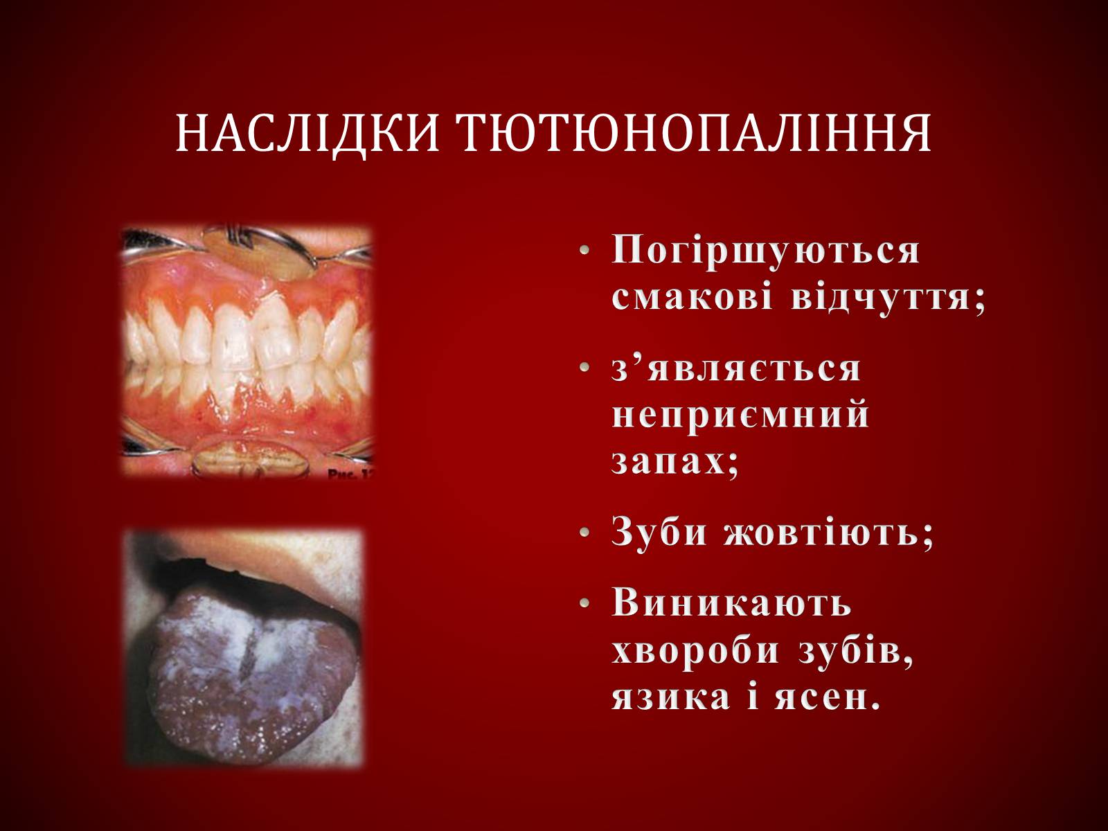 Презентація на тему «Шкідливий вплив тютюнопаління» (варіант 1) - Слайд #20 Презентація на тему «Шкідливий вплив тютюнопаління» (варіант 1) - Слайд #20