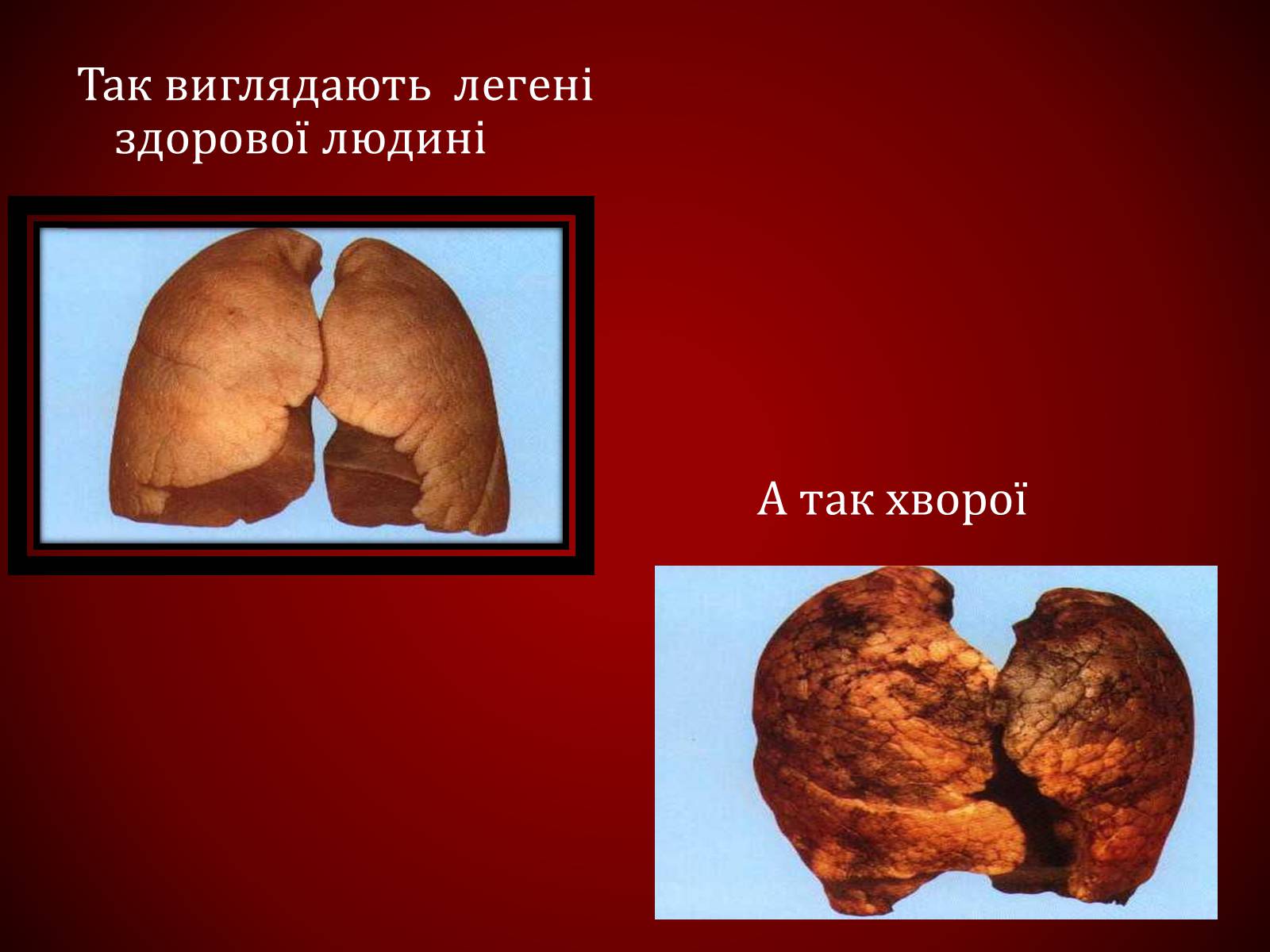 Презентація на тему «Шкідливий вплив тютюнопаління» (варіант 1) - Слайд #21 Презентація на тему «Шкідливий вплив тютюнопаління» (варіант 1) - Слайд #21