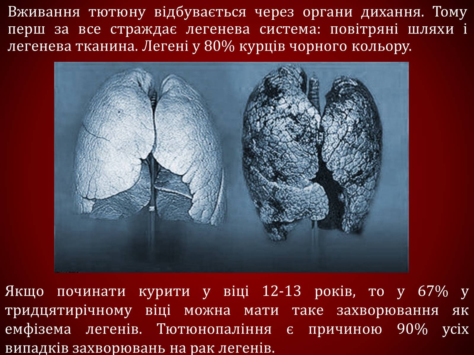 Презентація на тему «Шкідливий вплив тютюнопаління» (варіант 1) - Слайд #23 Презентація на тему «Шкідливий вплив тютюнопаління» (варіант 1) - Слайд #23