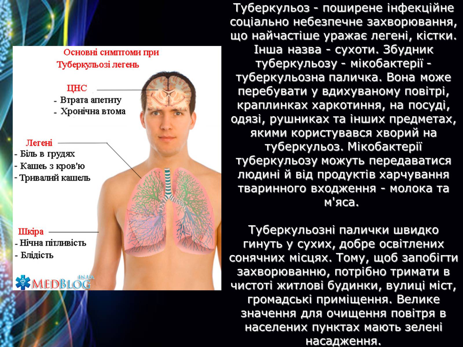 Презентація на тему «Захворювання дихальної системи» (варіант 2) - Слайд #11 Презентація на тему «Захворювання дихальної системи» (варіант 2) - Слайд #11