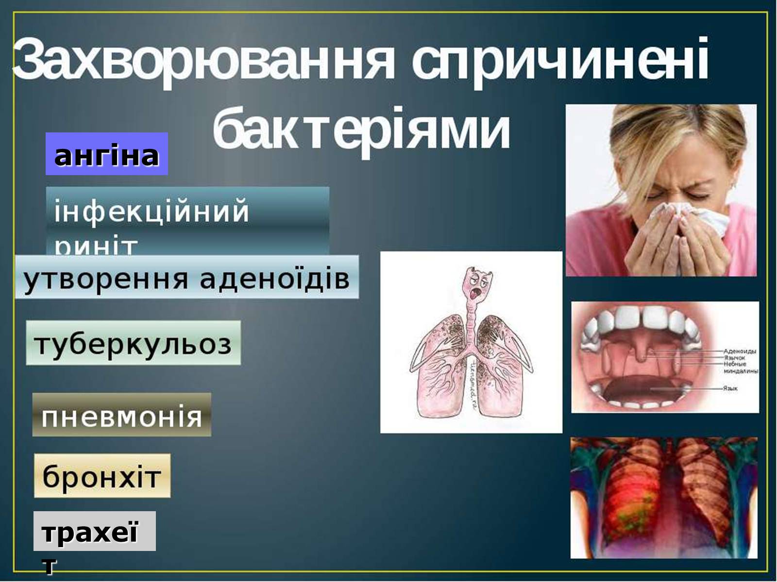 Презентація на тему «Захворювання дихальної системи» (варіант 2) - Слайд #6 Презентація на тему «Захворювання дихальної системи» (варіант 2) - Слайд #6