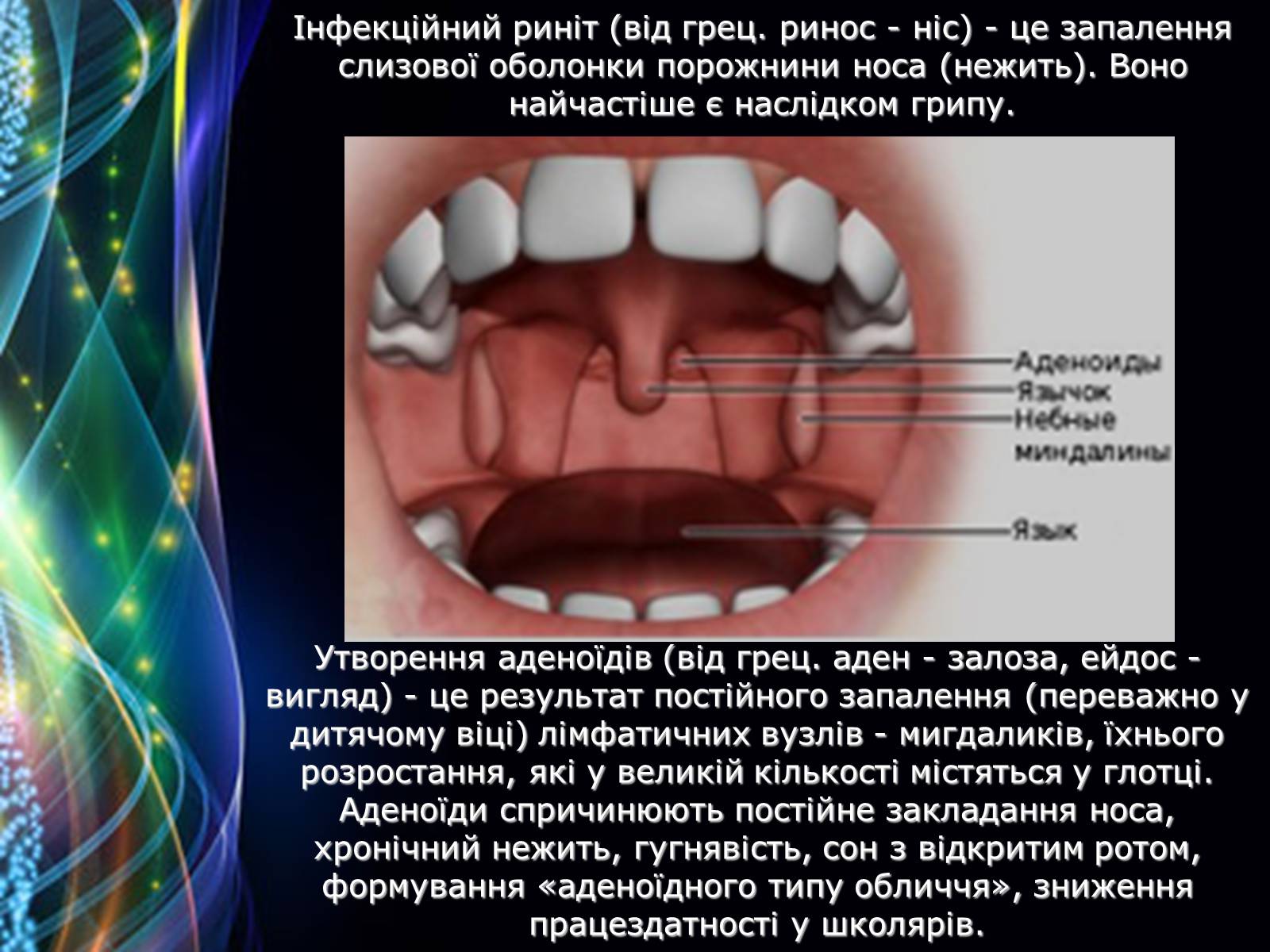 Презентація на тему «Захворювання дихальної системи» (варіант 2) - Слайд #7 Презентація на тему «Захворювання дихальної системи» (варіант 2) - Слайд #7