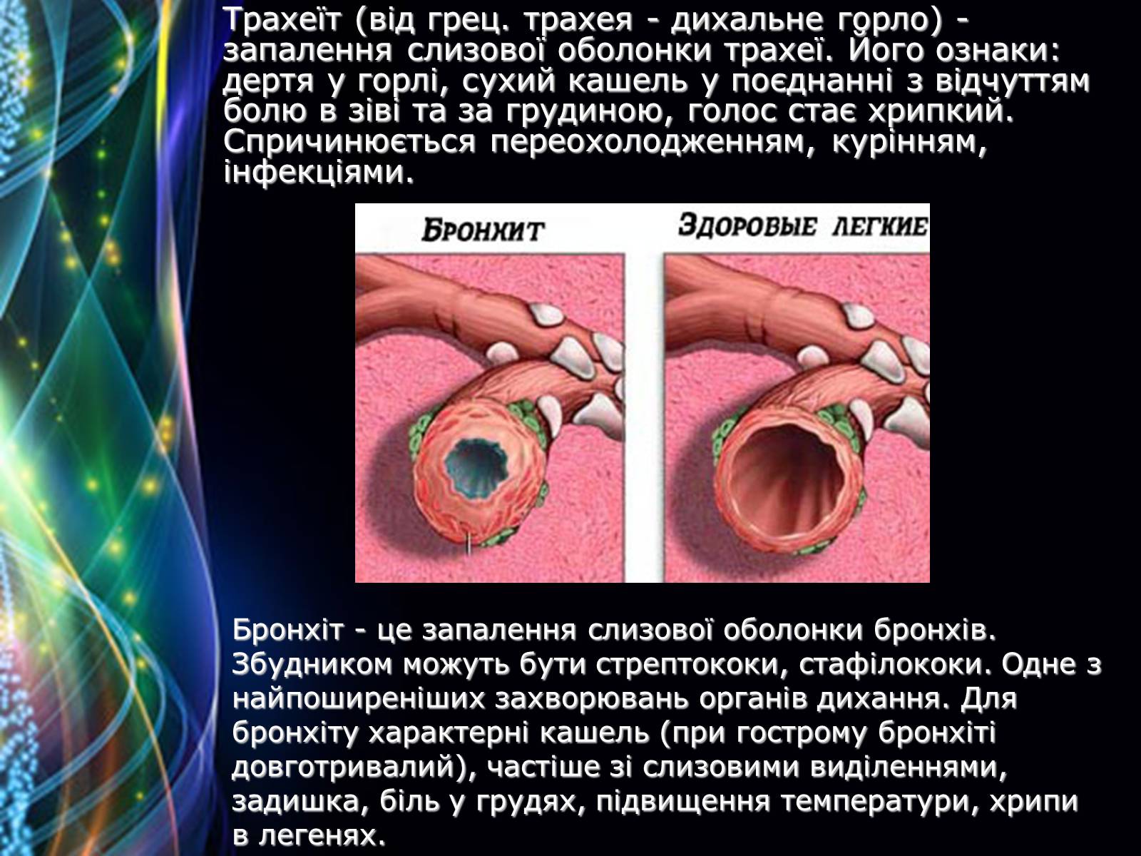 Презентація на тему «Захворювання дихальної системи» (варіант 2) - Слайд #9 Презентація на тему «Захворювання дихальної системи» (варіант 2) - Слайд #9