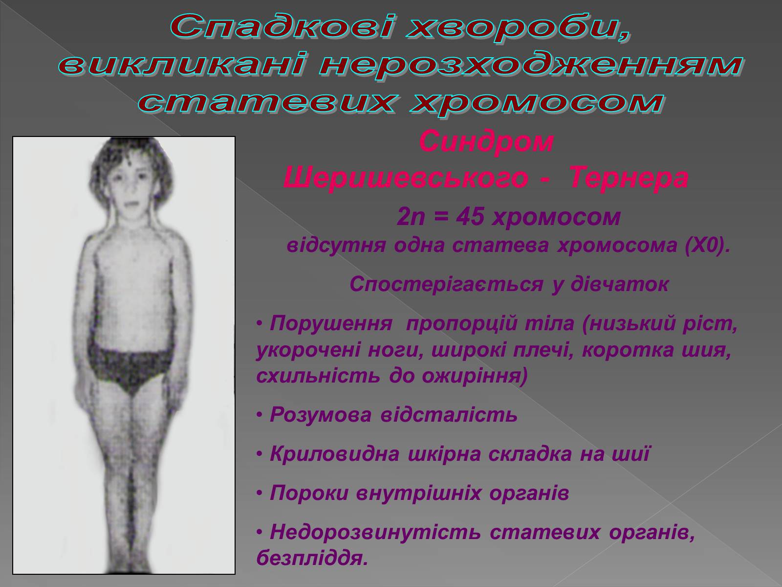 Презентація на тему «Генетика людини» (варіант 2) - Слайд #29 Презентація на тему «Генетика людини» (варіант 2) - Слайд #29