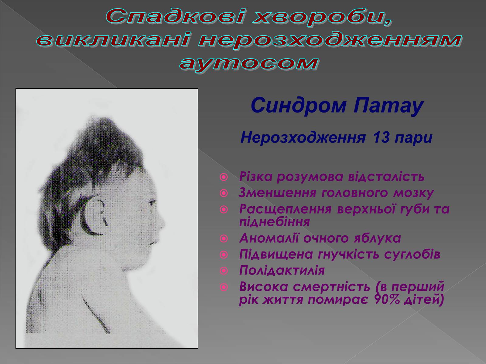 Презентація на тему «Генетика людини» (варіант 2) - Слайд #31 Презентація на тему «Генетика людини» (варіант 2) - Слайд #31