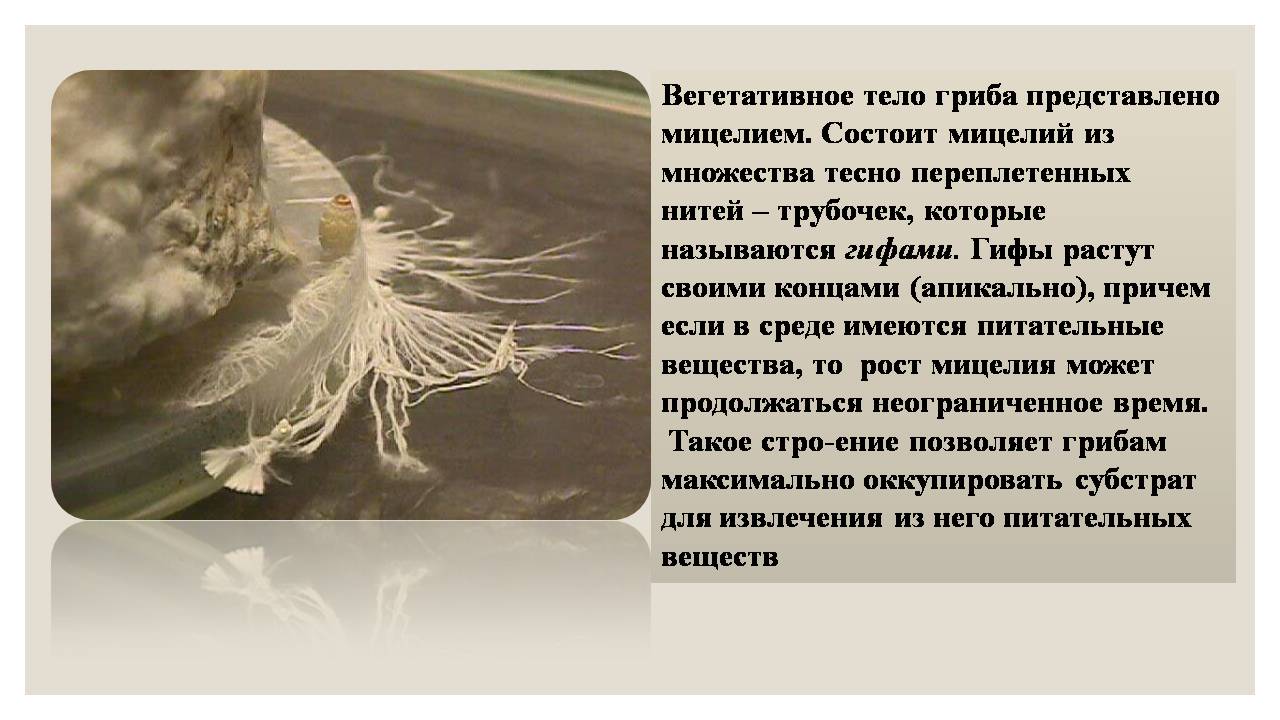 Презентація на тему «Микроорганизмы. Грибы» - Слайд #10 Презентація на тему «Микроорганизмы. Грибы» - Слайд #10