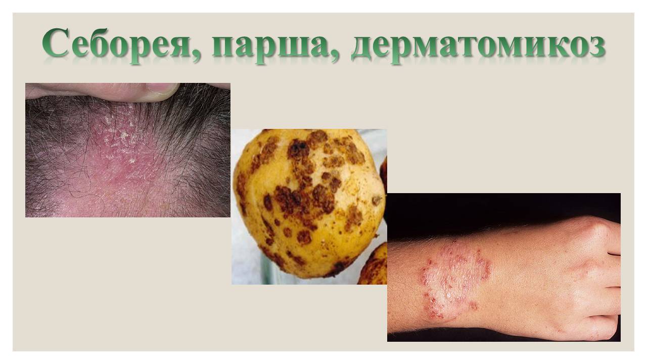 Презентація на тему «Микроорганизмы. Грибы» - Слайд #18 Презентація на тему «Микроорганизмы. Грибы» - Слайд #18