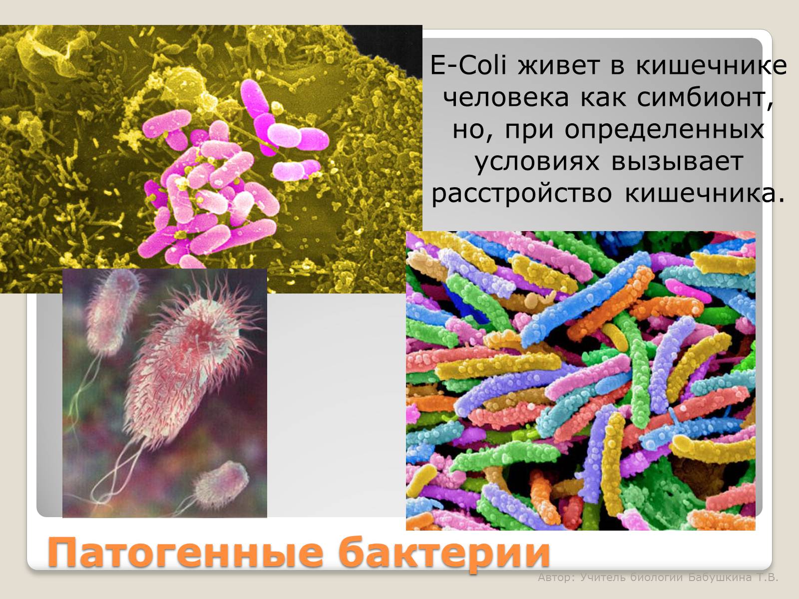Презентація на тему «Царство Бактерии» - Слайд #15 Презентація на тему «Царство Бактерии» - Слайд #15