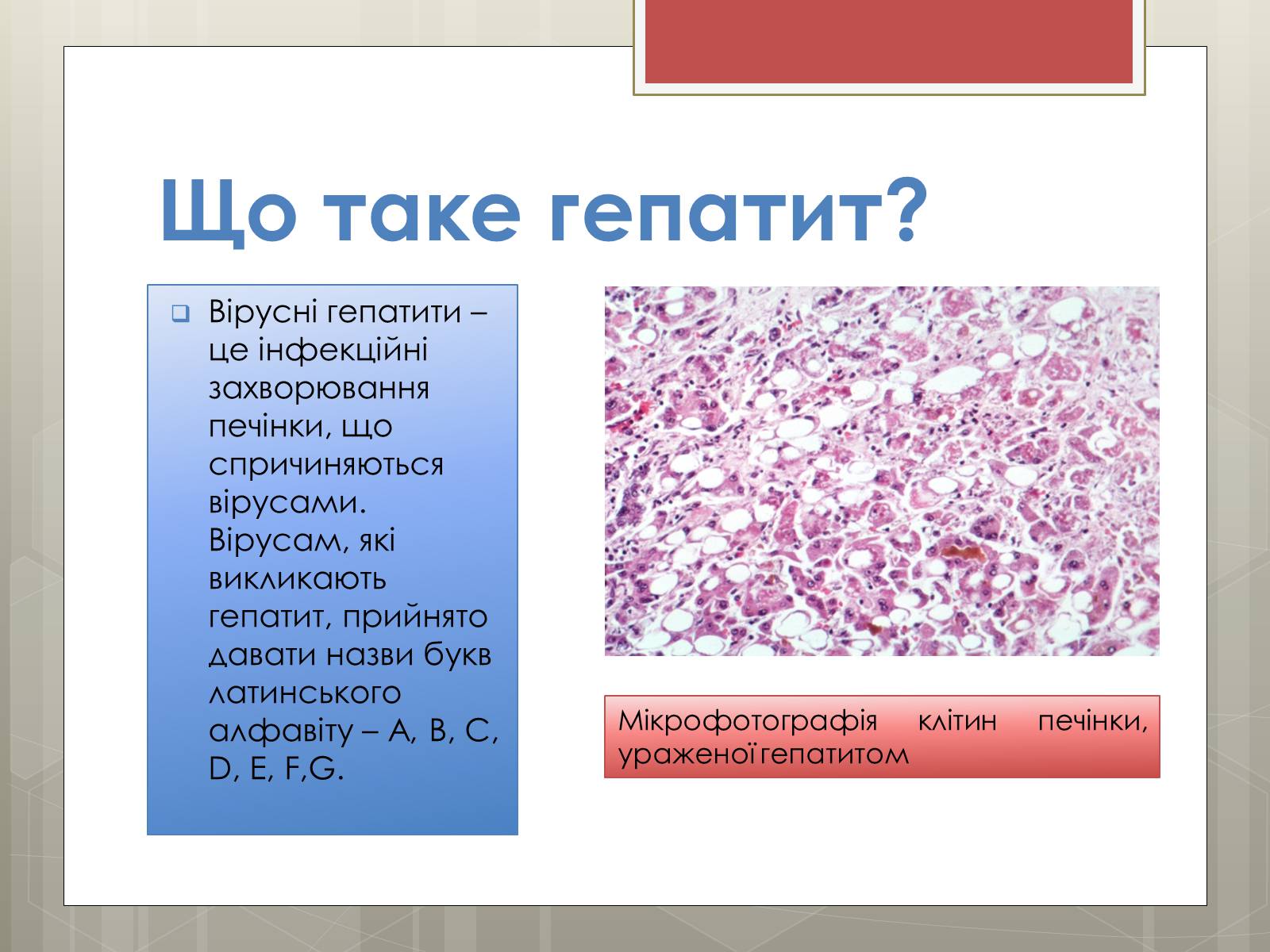 Презентація на тему «Вірусні гепатити» (варіант 1) - Слайд #2 Презентація на тему «Вірусні гепатити» (варіант 1) - Слайд #2